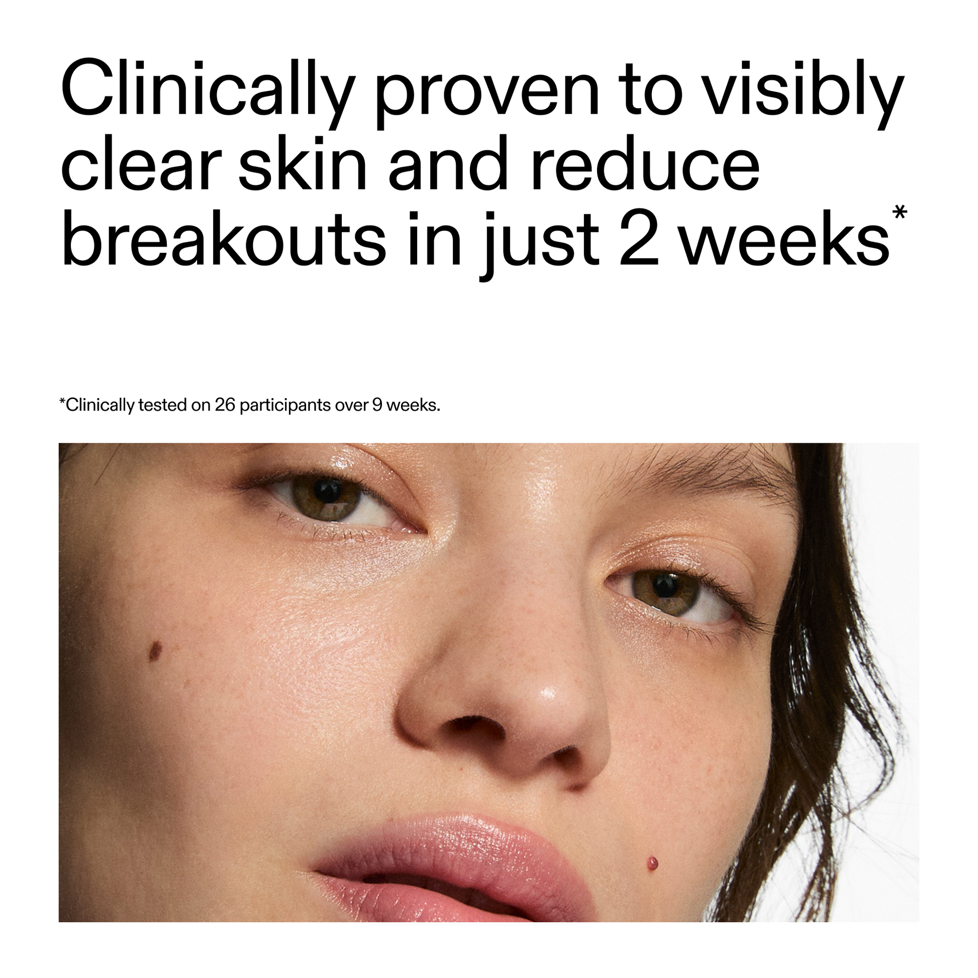 360-acne-clearing-duo-b1 360_Serum_Key_Claim.png