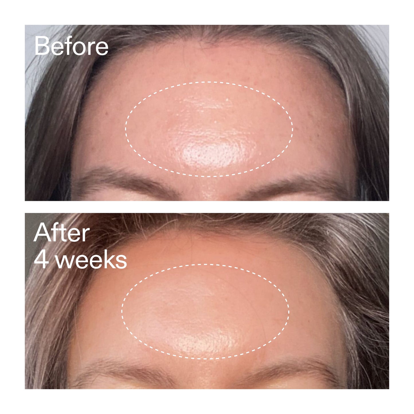 advanced-0-2-retinal-serum-duo-s2 AdvancedRetinal_BeforeAfter1_2000x2000_4e9c798a-f30e-45b8-a34a-7c4740f2f2cb.jpg