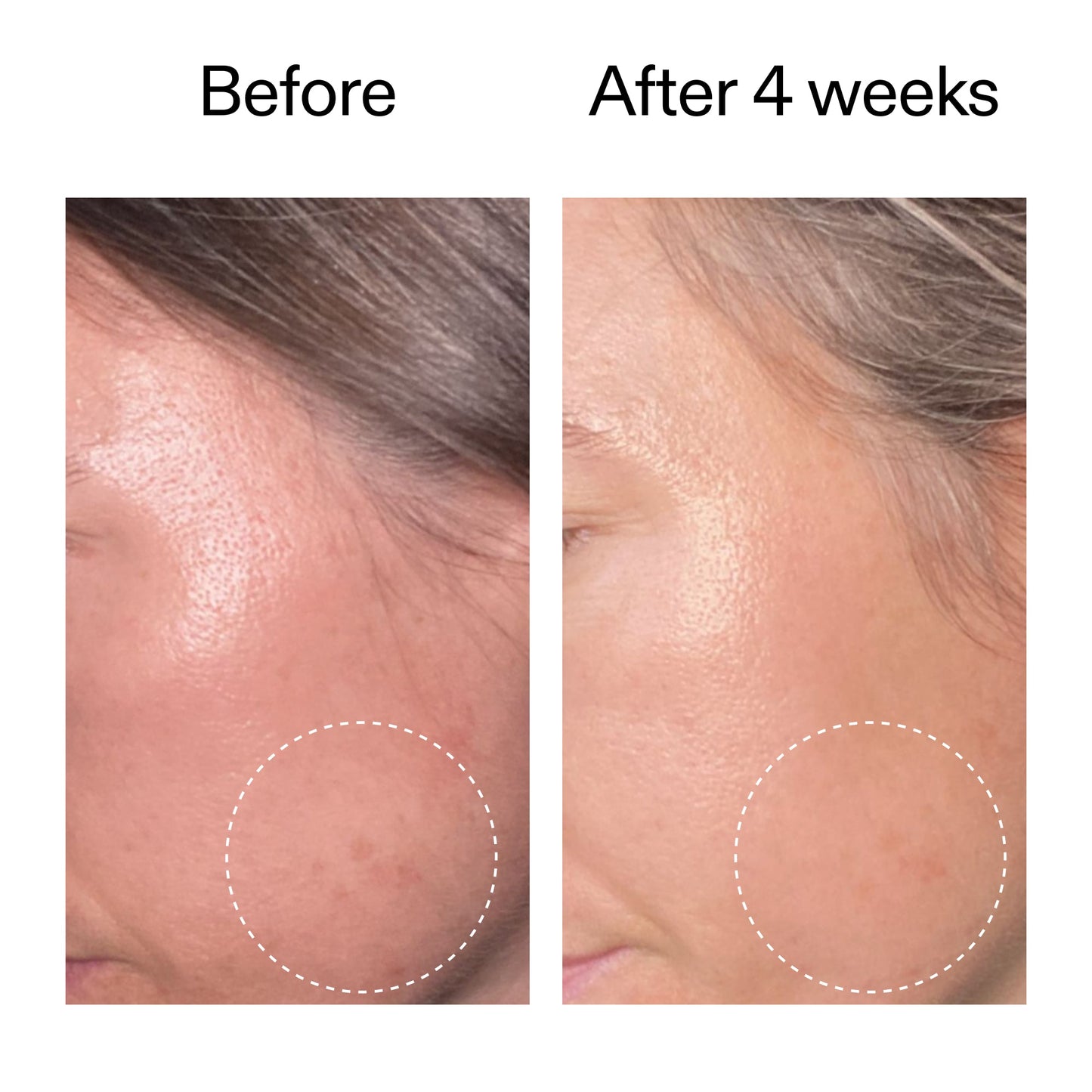 advanced-0-2-retinal-serum-z8 AdvancedRetinal_BeforeAfter2__2000x2000_62fb16bb-77ae-4d63-8500-88dbf847f4b9.jpg