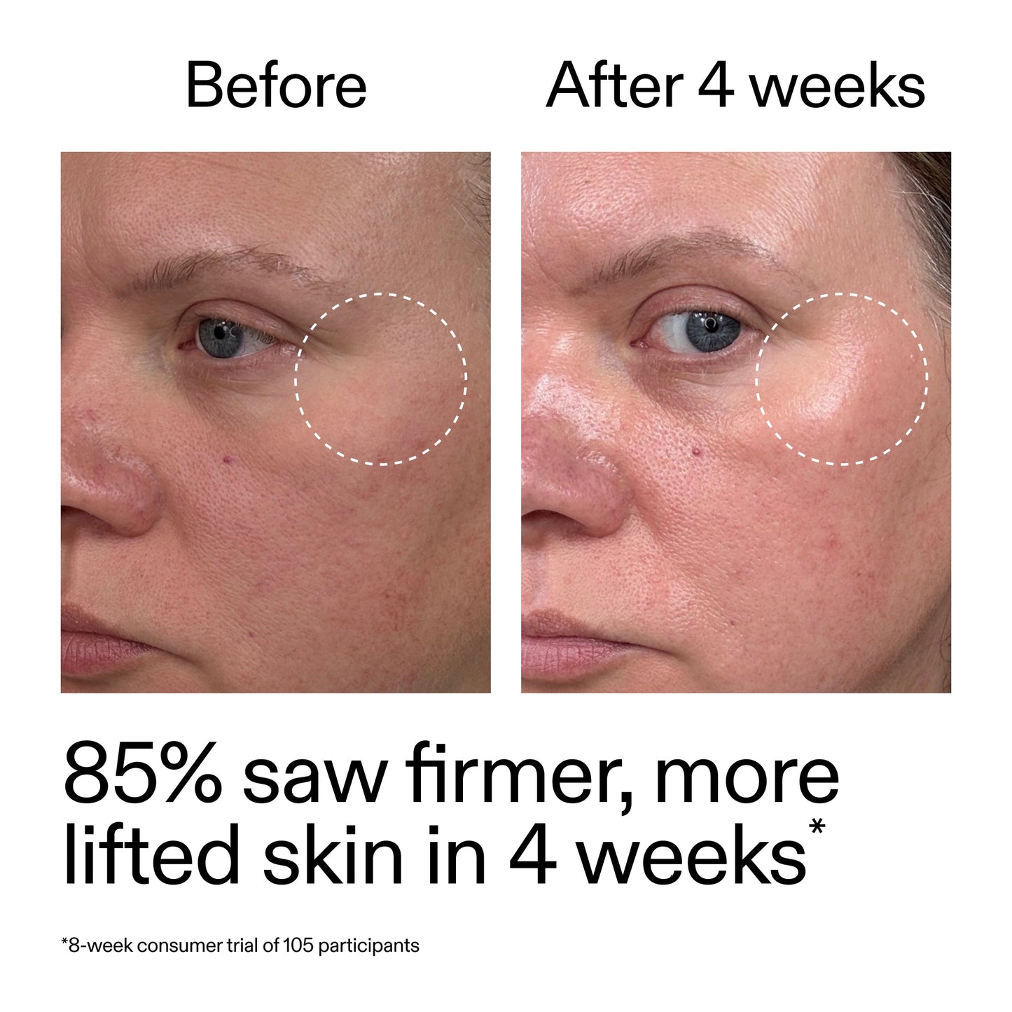 advanced-0-2-retinal-serum-duo-s2 AdvancedRetinal_BeforeAfter_Claim1_2000x2000_3a315aa8-f408-4b33-bbeb-0d9209f98404.jpg