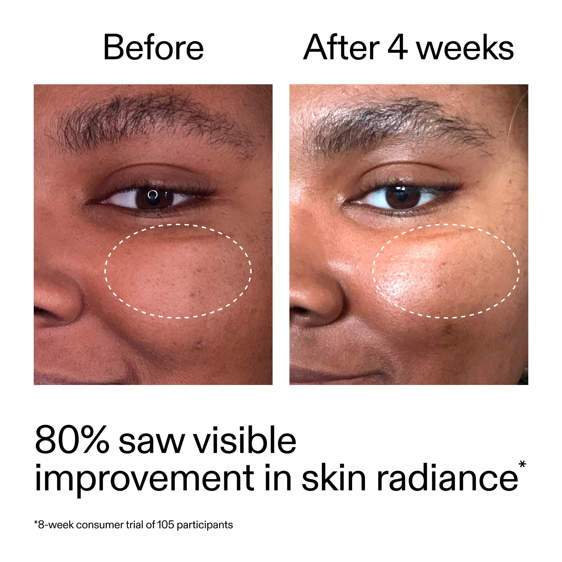 advanced-0-2-retinal-serum-p9 AdvancedRetinal_BeforeAfter_Claim2_2000x2000_39d11e3d-eda9-44ec-ab32-2903b1a368bd.jpg