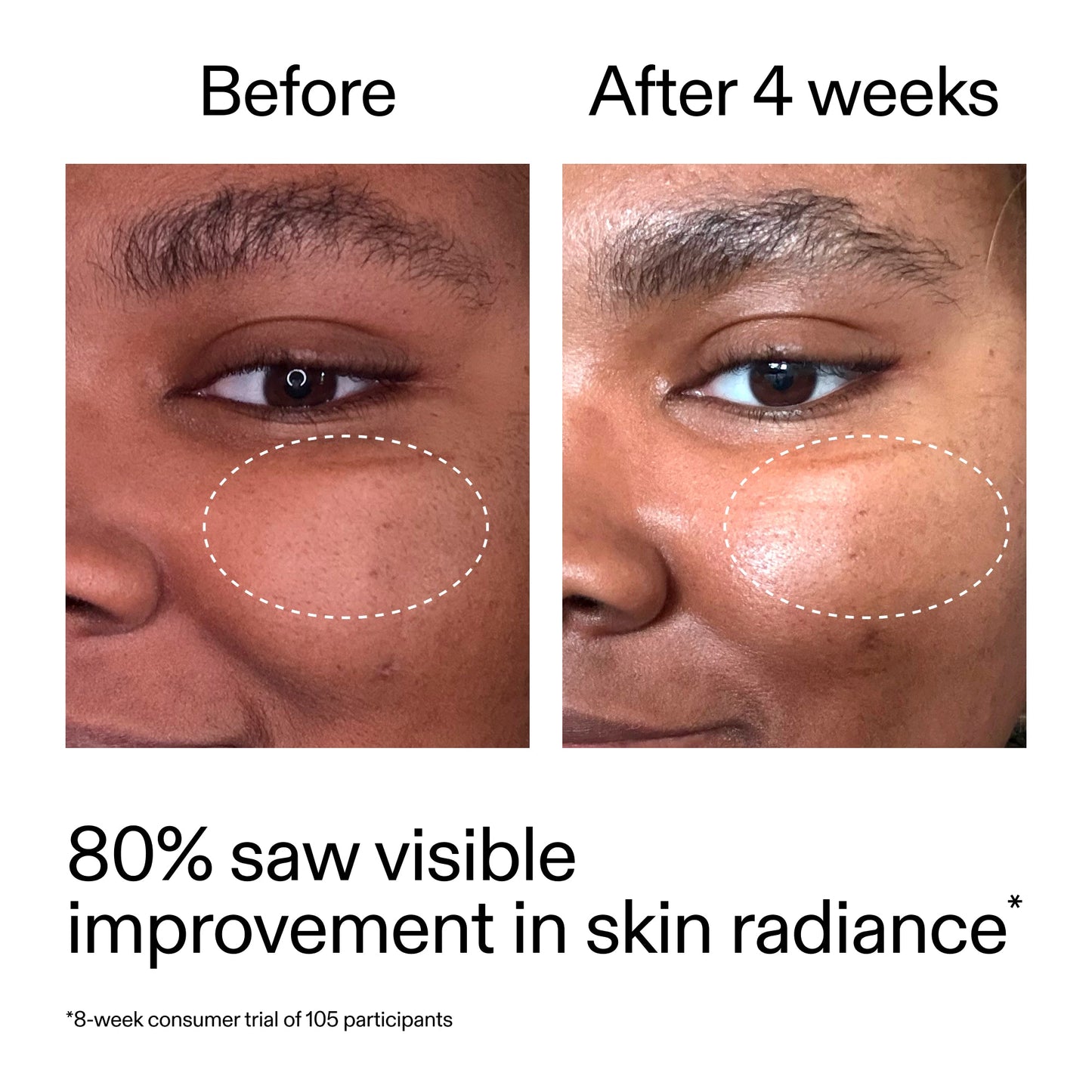 advanced-0-2-retinal-serum-duo-s2 AdvancedRetinal_BeforeAfter_Claim2_2000x2000_681b621d-8d44-4d44-9a40-89244f9b2e53.jpg