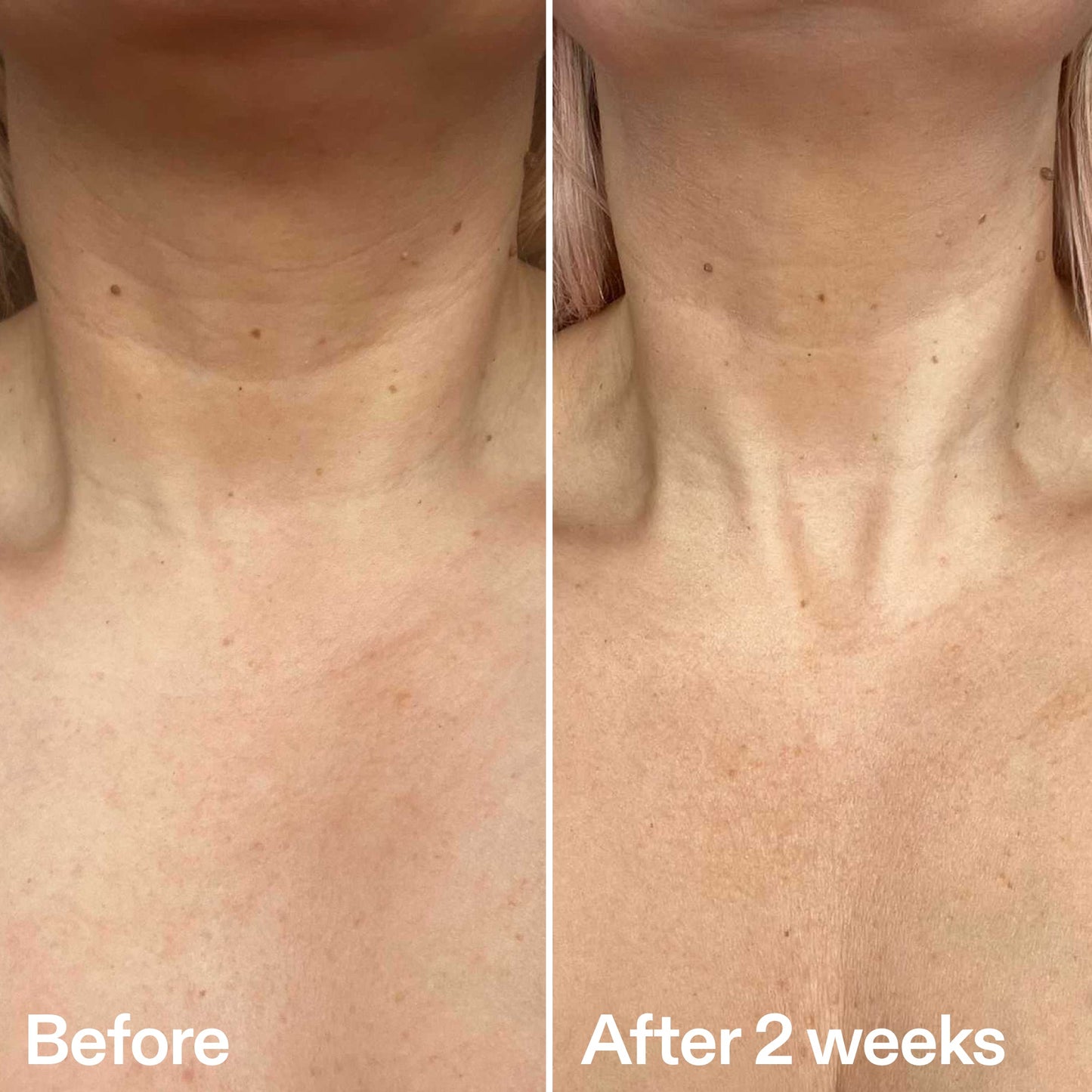 bio-active-neck-lift-stick-s5 B_A_2.jpg