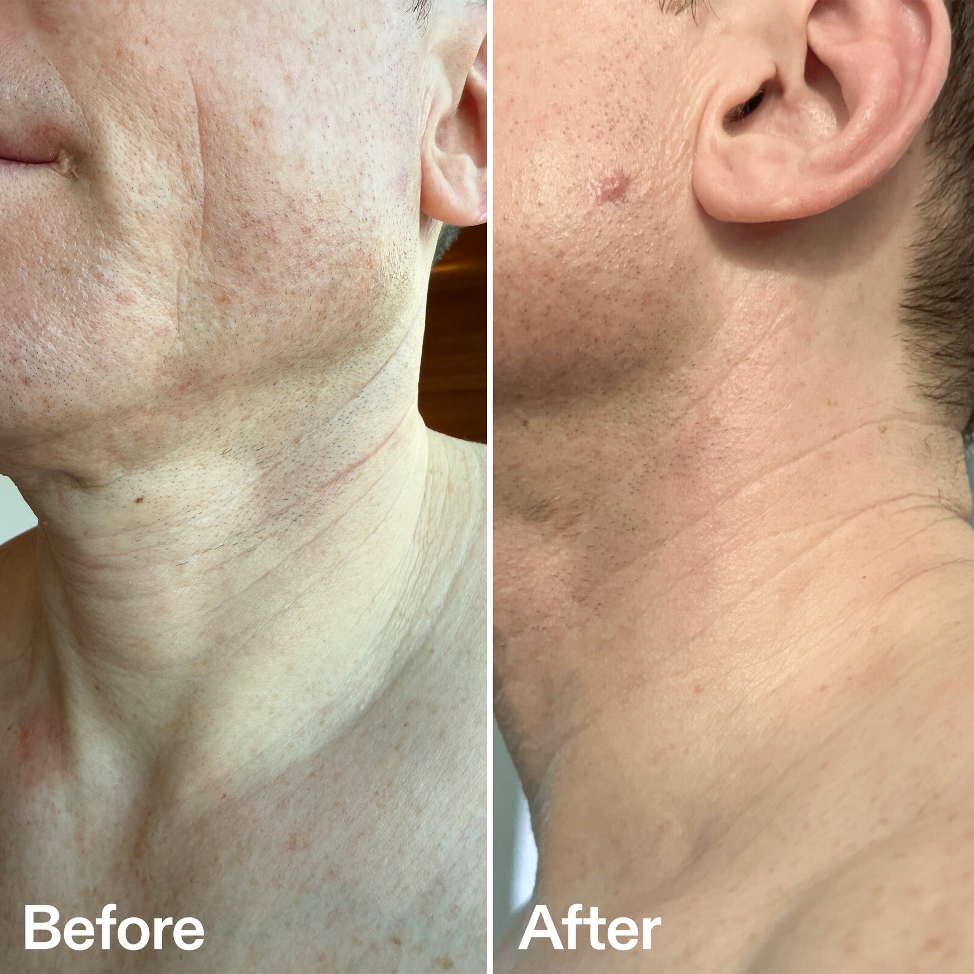 bio-active-neck-lift-stick-s5 B_A_afa2743e-b8e2-4504-92f4-e281cb6cf759.jpg