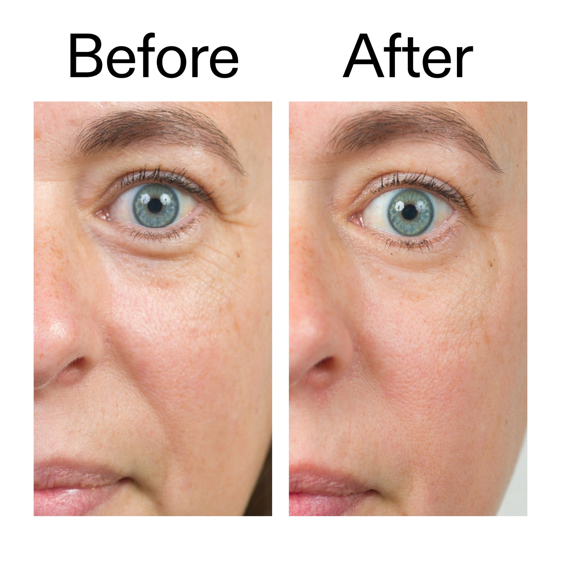 bio-active-ceramide-moisturizer-duo-j4 Bio-Active_Before_After_2000x2000_566e5a9e-135e-417a-8242-b44e5fa35463.jpg