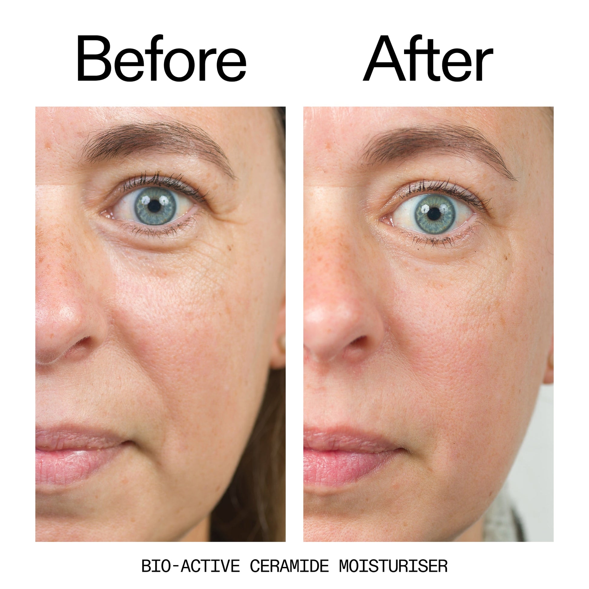 barrier-boosting-trio-z9 Bio-Active_Before_After_2000x2000_600947b4-e8c5-425a-9155-fc15bc83aa12.jpg