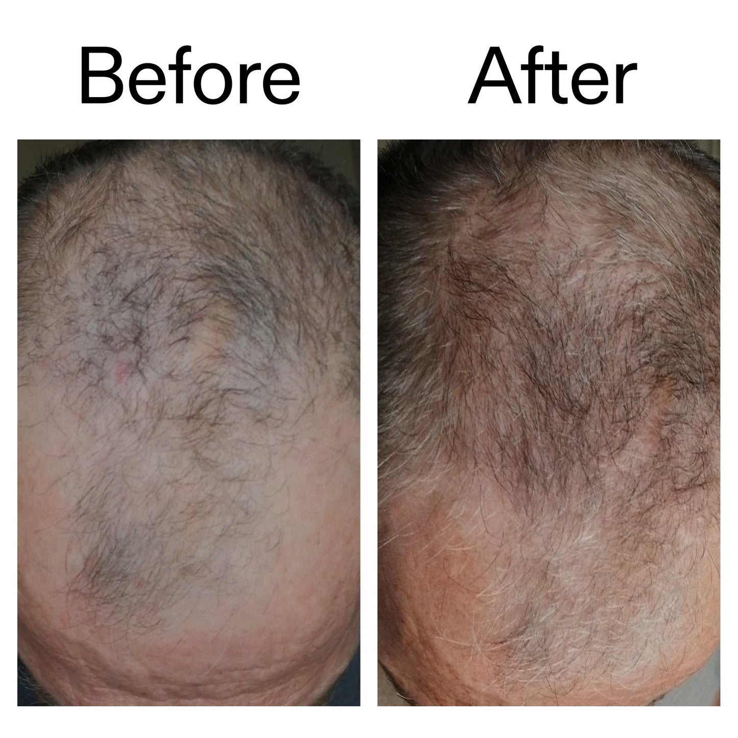 3-month-hair-growth-trio-m8 Caffeine_Scalp_Treatment_B_A_Ppage_2000_x_2000.jpg