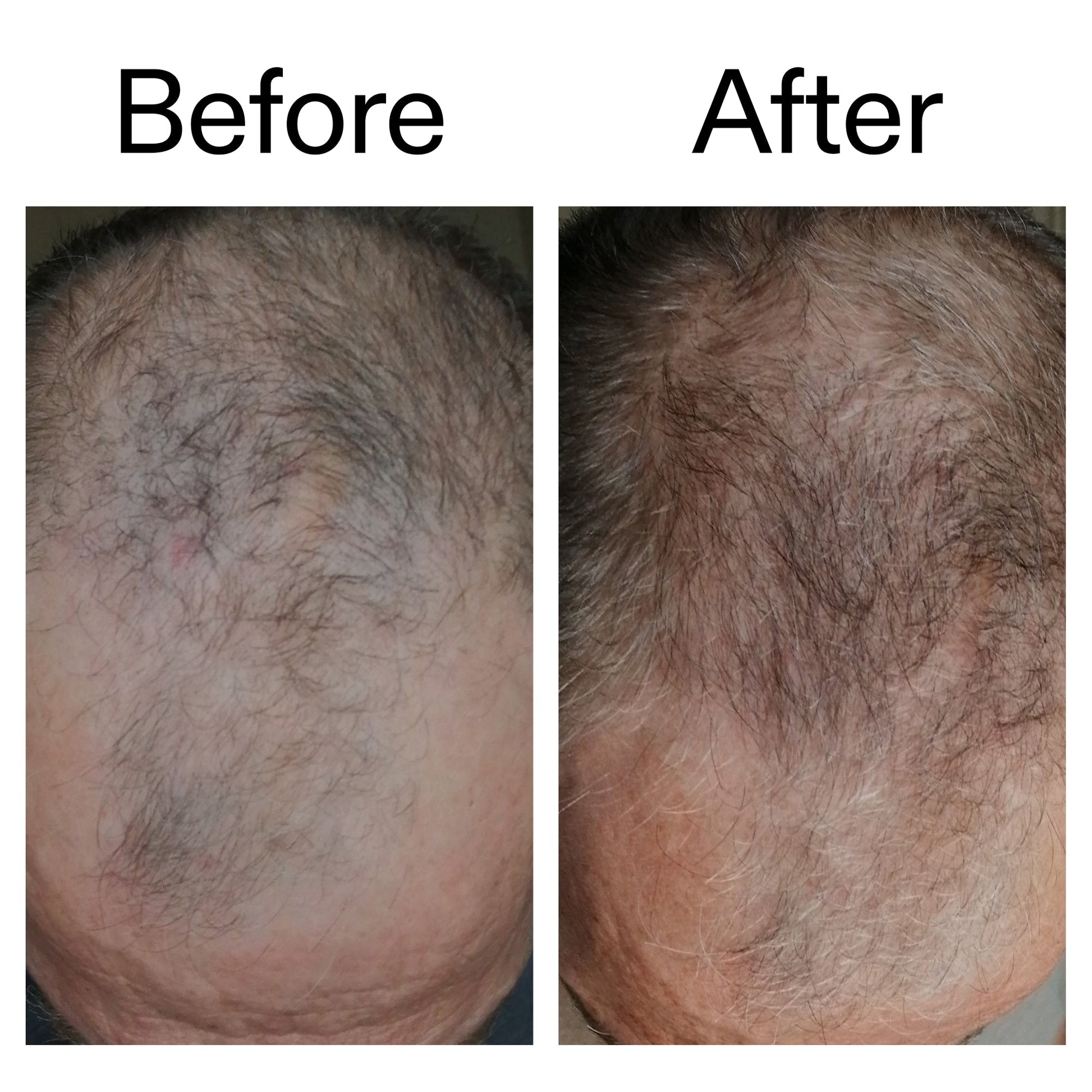 3-month-hair-growth-trio-m8 Caffeine_Scalp_Treatment_B_A_Ppage_2000_x_2000.jpg