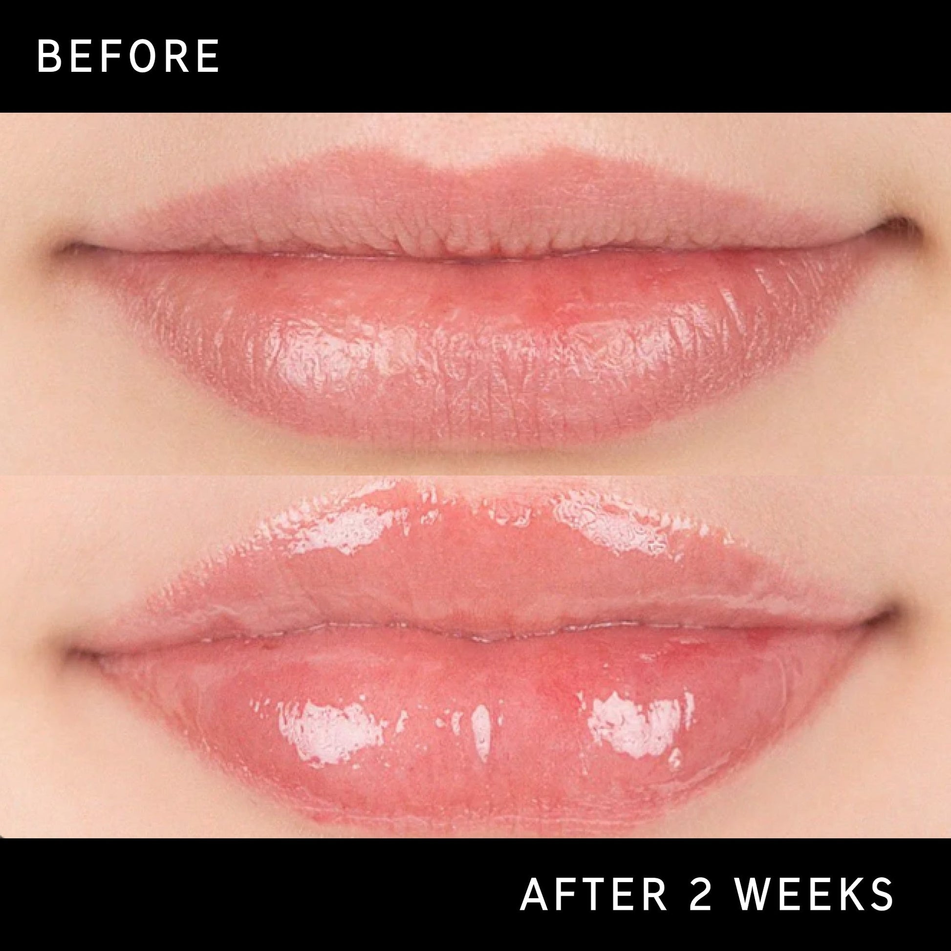 lip-plumping-duo-z0 DTC-Top15_Amends_Tripeptide-Lip_B_A.jpg