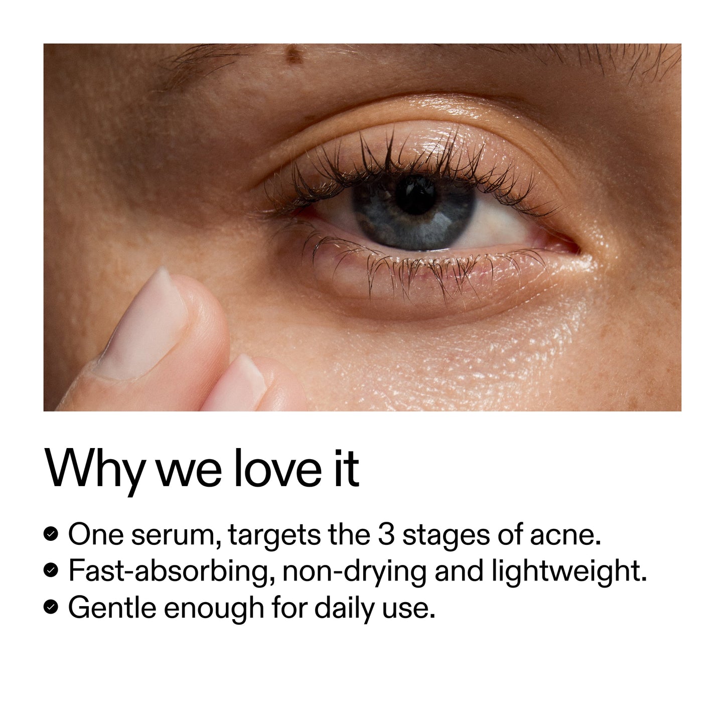 360-acne-clearing-duo-b1 Dioic_Whyweloveit_2000x2000_175aafd3-0cbe-403a-b317-a8362881bfe2.jpg