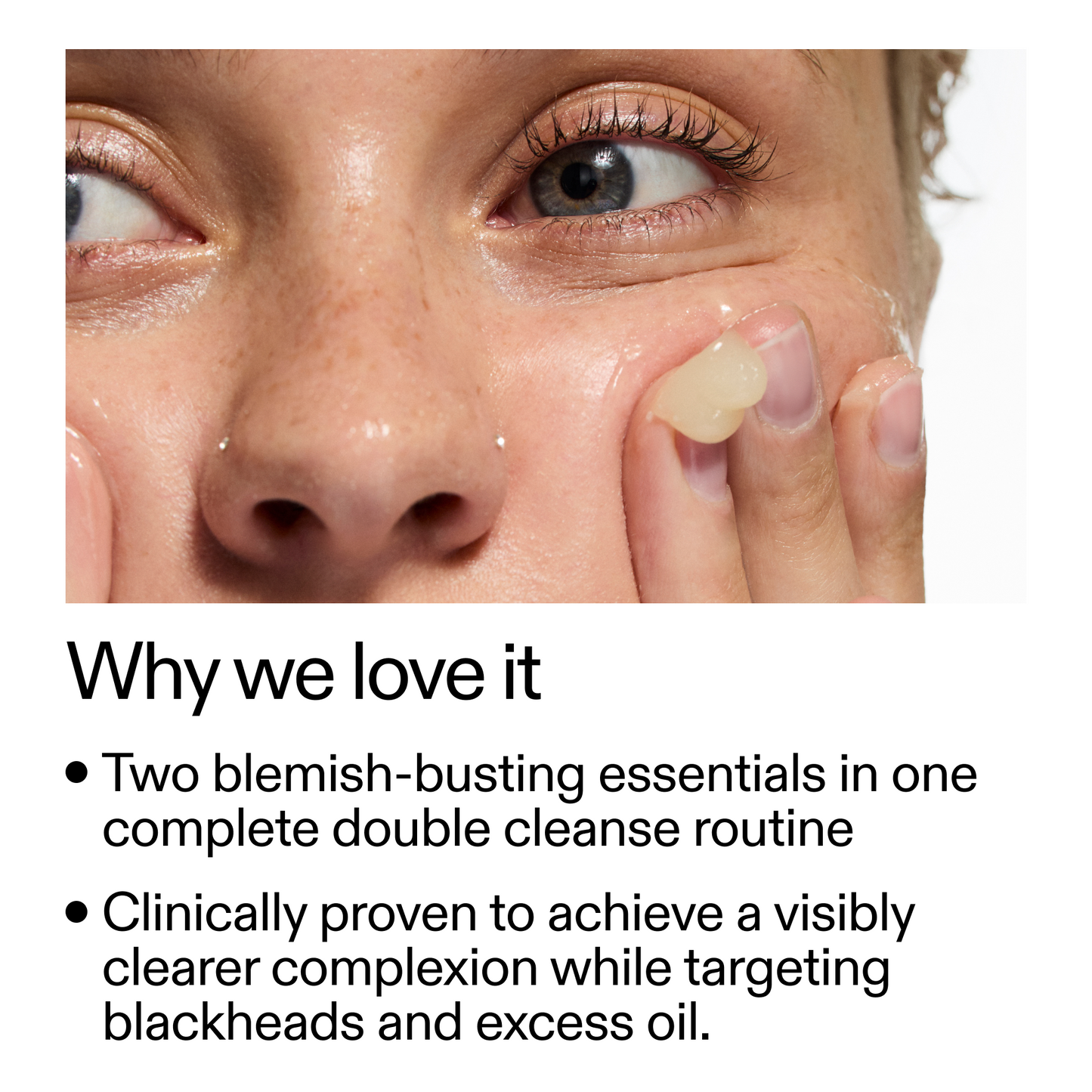 acne-double-cleanse-duo-y0 Double_Cleanse_Duo_for_Breakouts_Why_We_2000x2000_f242cb12-bb5c-487c-b203-071ccb406ec5.png
