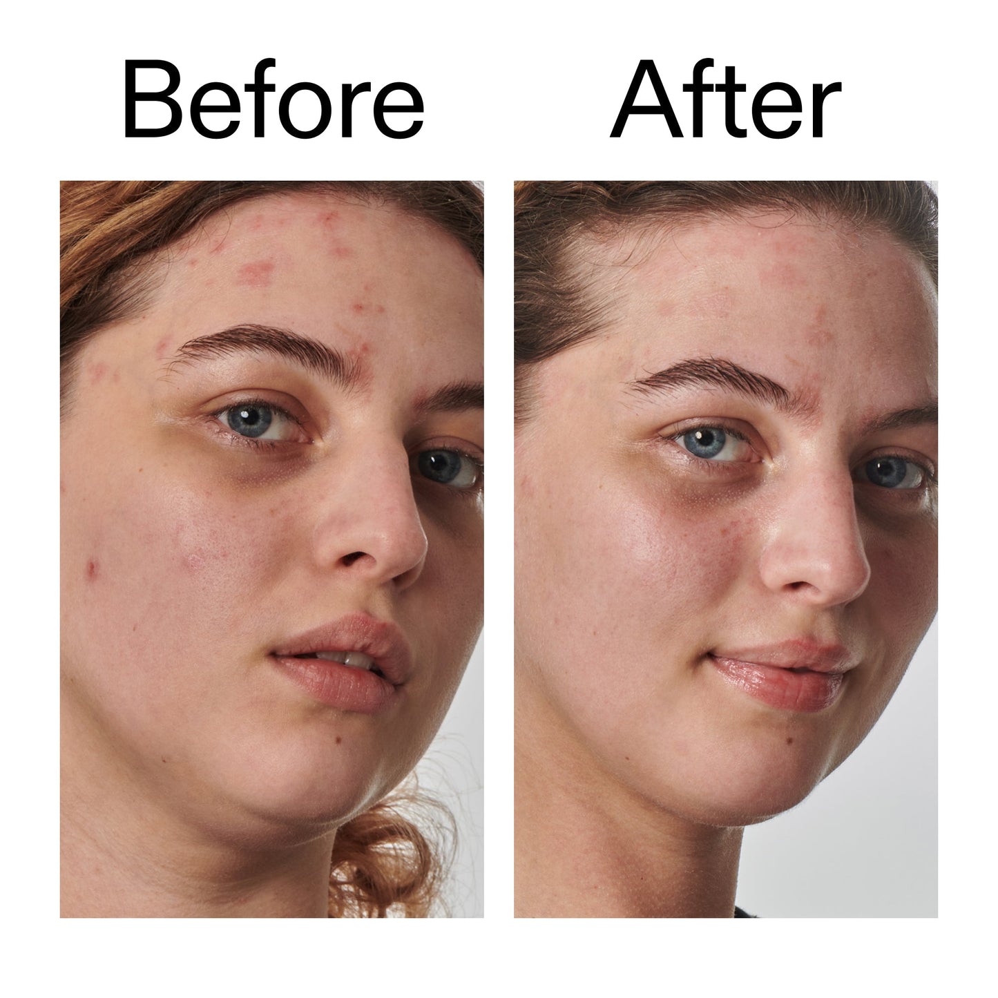 10-urea-moisturizer-z4 Dry_and_Rough_Skin_Solution_Before_After_2000x2000_efa6e639-5c39-49bd-a5dd-f0220293120a.jpg