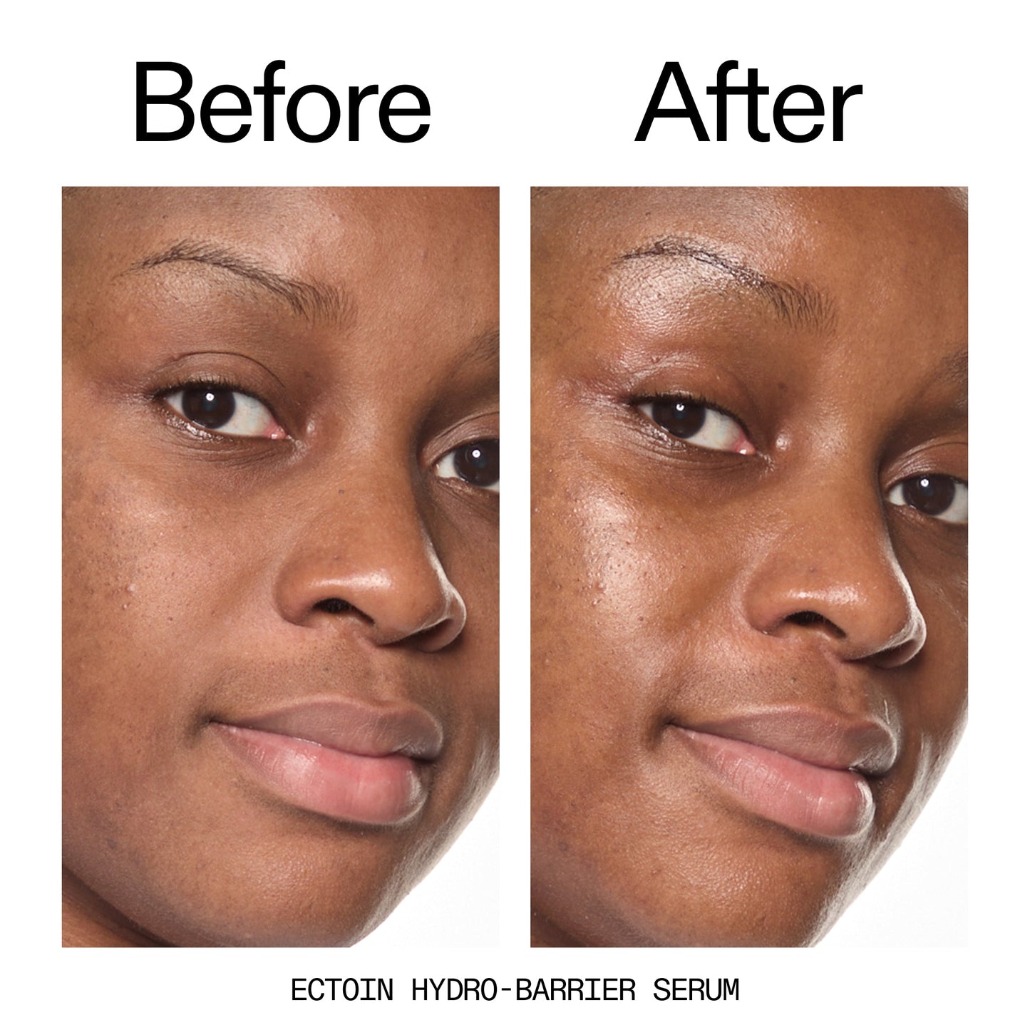 barrier-boosting-trio-z9 Ectoin_Before_After_2000x2000_ce35bc41-4da0-4b6f-adc7-29f8641f6c6c.jpg