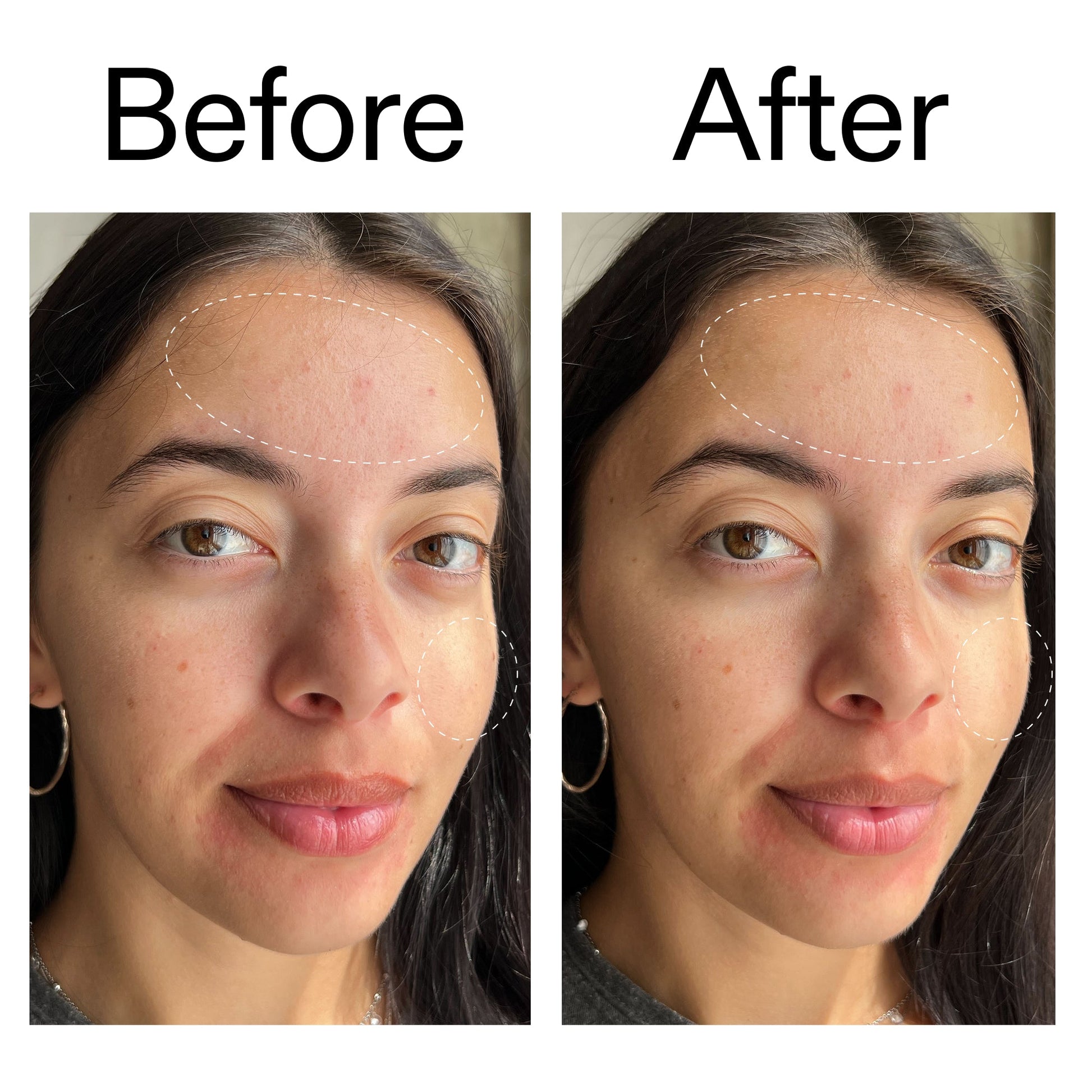 glycerin-gentle-purifying-cleanser-w3 Glycerin_B_A_2000x2000_19037705-c220-4333-99c1-e648cc3ac1d7.jpg