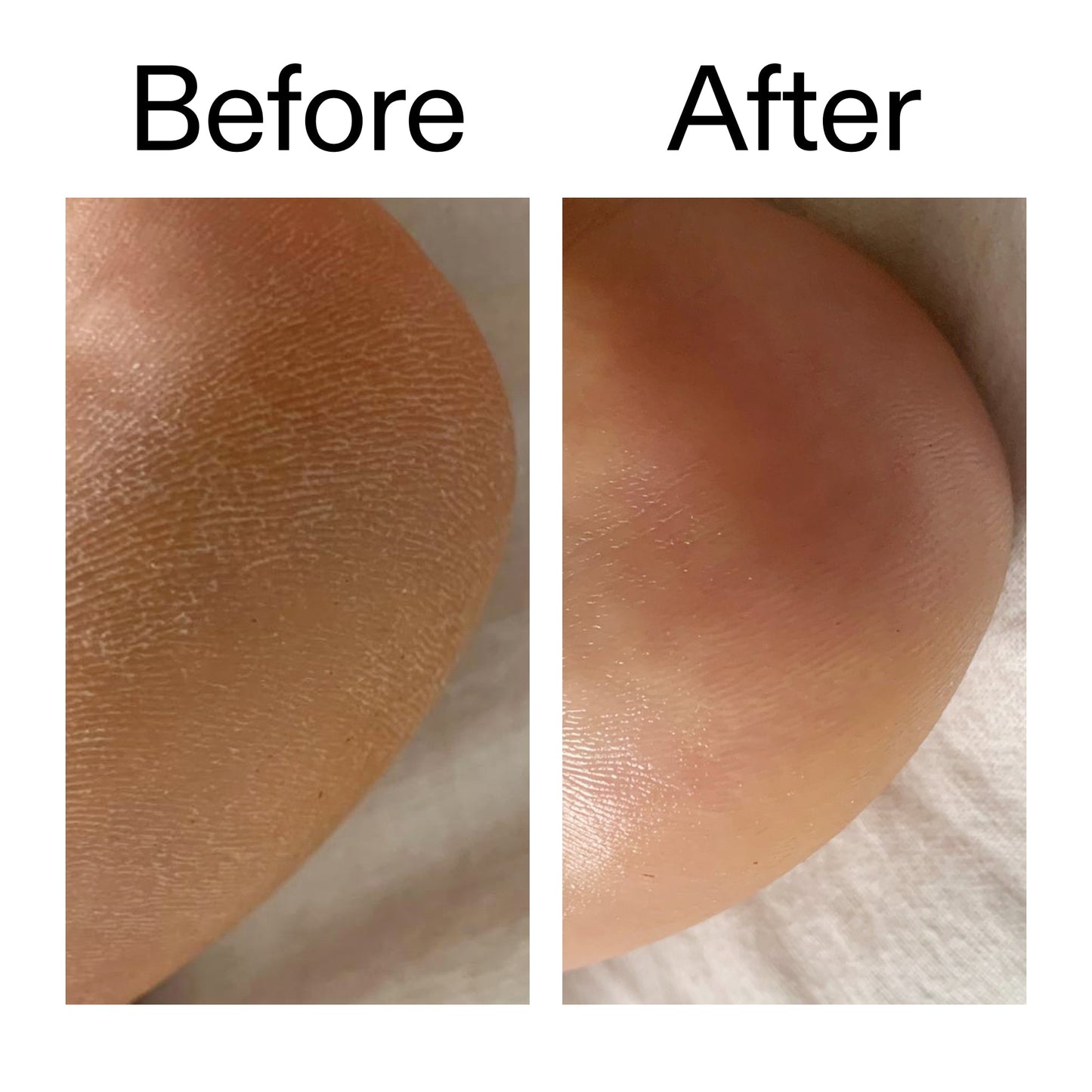 glycolic-acid-exfoliating-body-stick-f4 Glycolic_Acid_Exfoliating_Body_Stick_Before_After_V1_2000x2000_a3043625-9400-429a-a7fb-d6dbd220f722.jpg