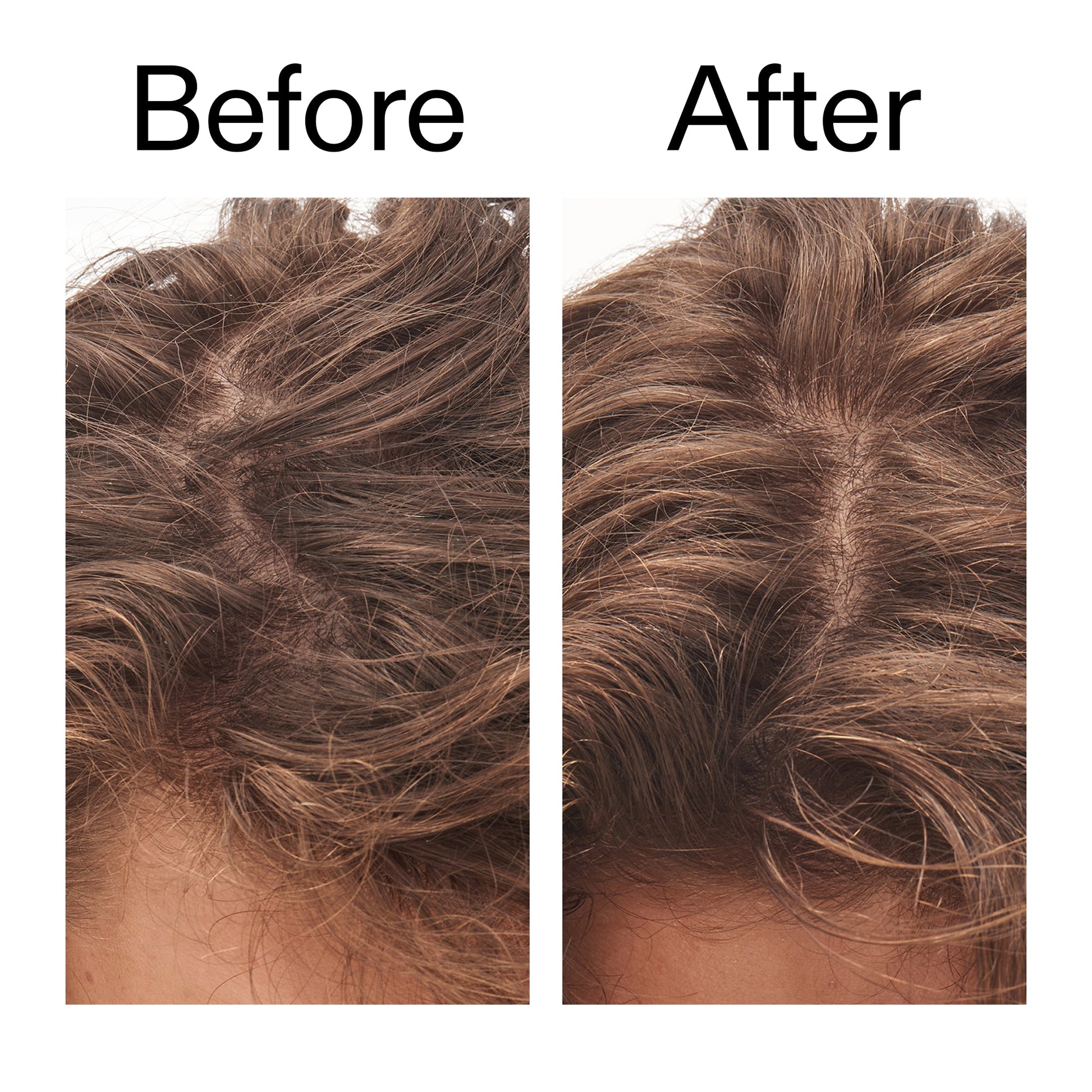 glycolic-acid-exfoliating-scalp-scrub-r4 Glycolic_Acid_Exfoliating_Scalp_Scrub_Before_After_2000x2000_b8561c87-05a1-4caa-80f7-1b6b33d750f7.jpg
