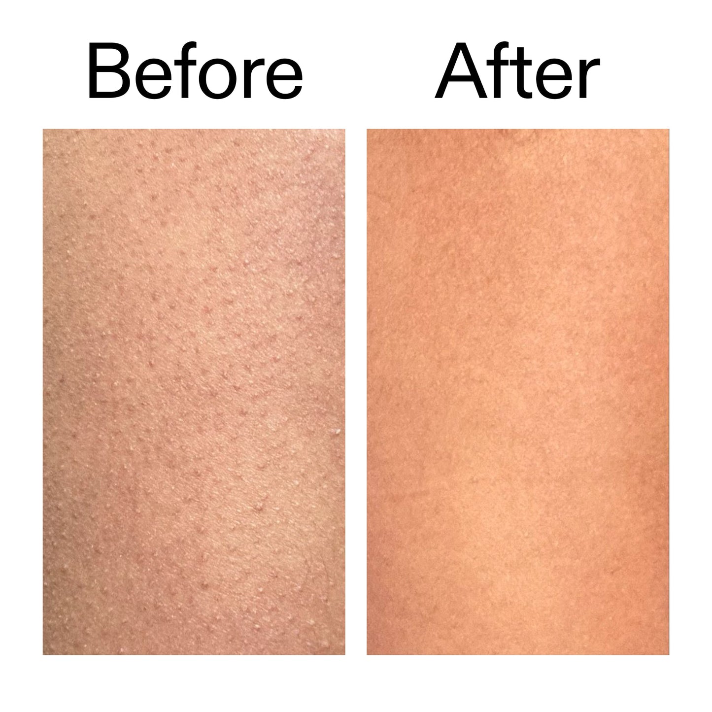 glycolic-acid-exfoliating-body-stick-duo-q0 Glycolic_Body_Stick_B_A_2000x2000_6e6e6b4d-5bd7-43c0-aeed-4d66788e8995.jpg