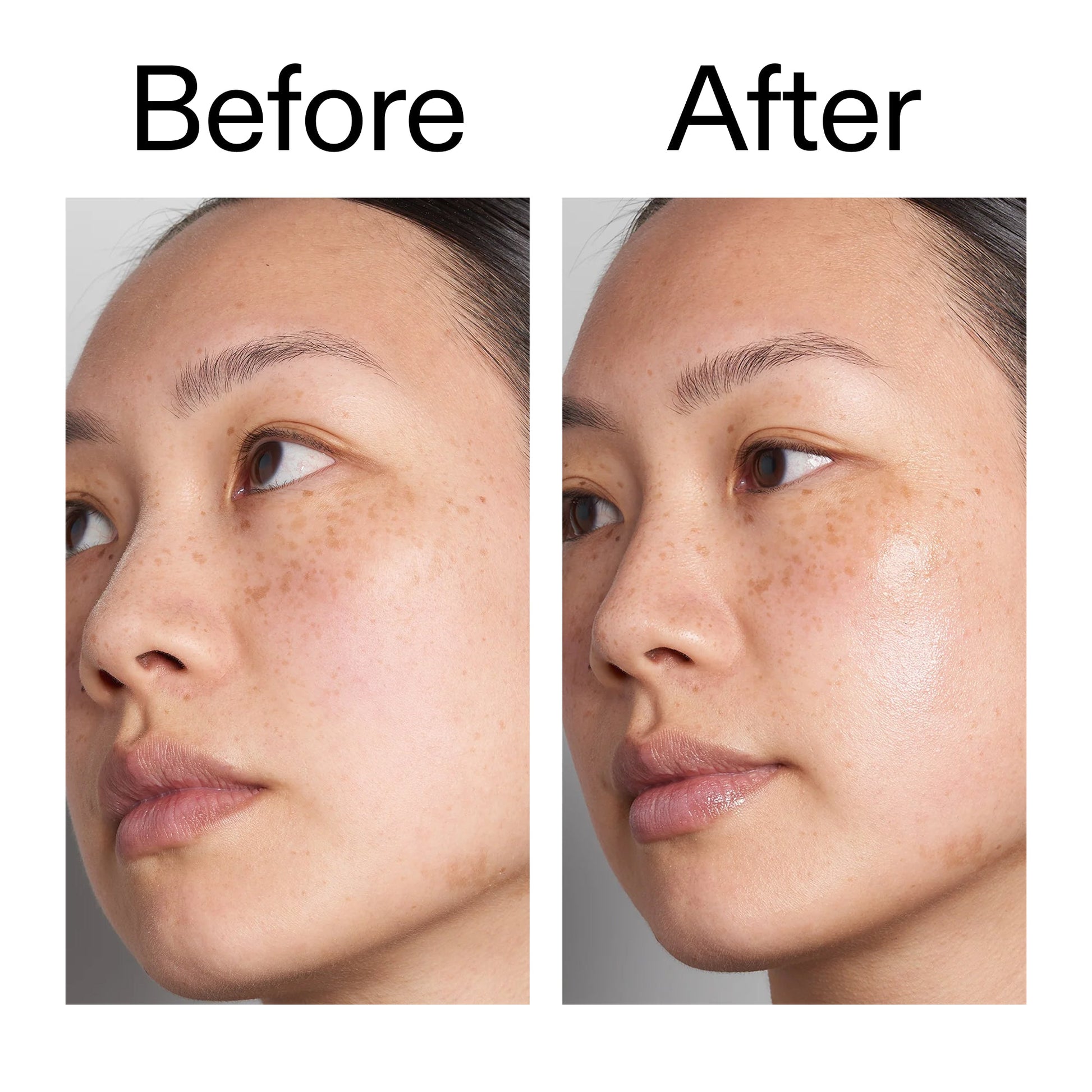 hyaluronic-acid-serum-30ml-x6 Hyaluronic_Acid_Before_After_2000x2000_d7983956-8aa2-4ea3-8255-c63e8d4f892e.jpg