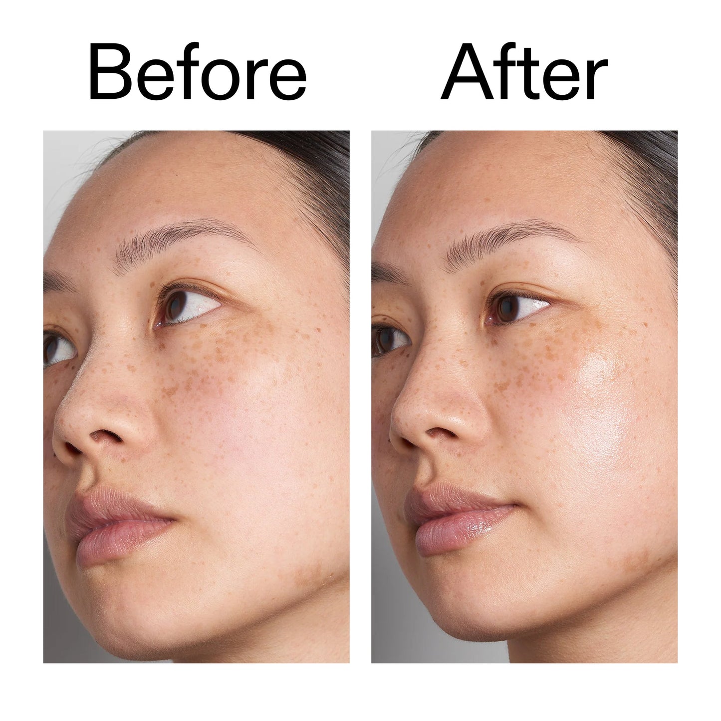 supersize-hyaluronic-acid-serum-100ml-a1 Hyaluronic_Acid_Before_After_2000x2000_d7983956-8aa2-4ea3-8255-c63e8d4f892e.jpg