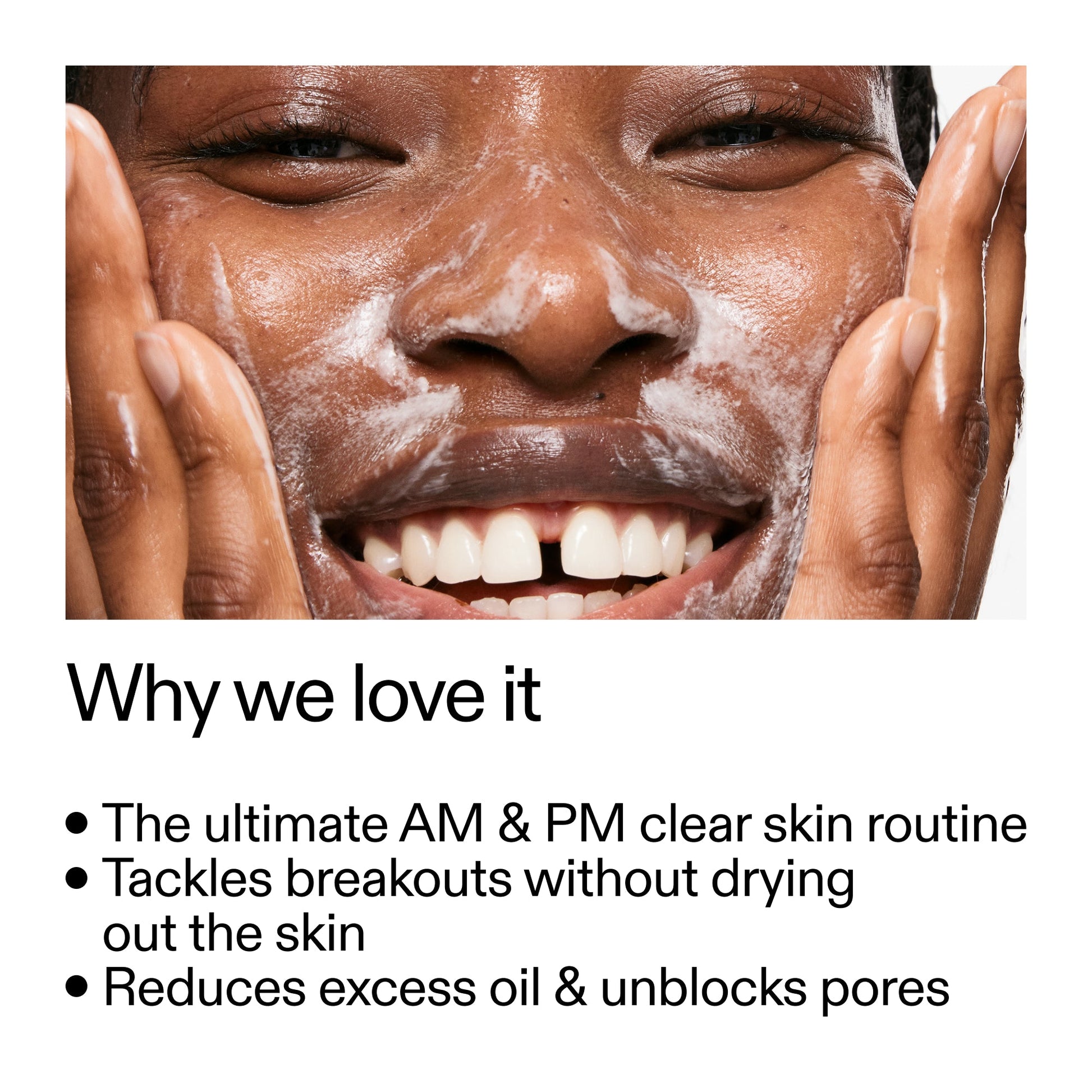 intro-routine-for-acne-s0 Intro_Routine_for_Acne_Why_we_love_it_2000x2000_42499e10-4629-4a0e-a627-7e215f4da6bc.jpg