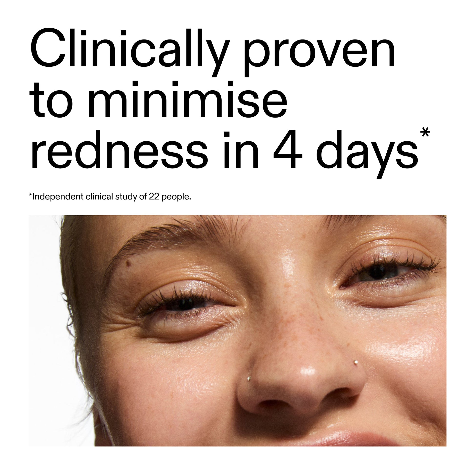 10-azelaic-acid-serum-for-redness-relief-l5 Oat_Cleansing_Balm_Claim_2000x2000_52a841dc-353c-4f2c-8646-3aadb604507d.jpg