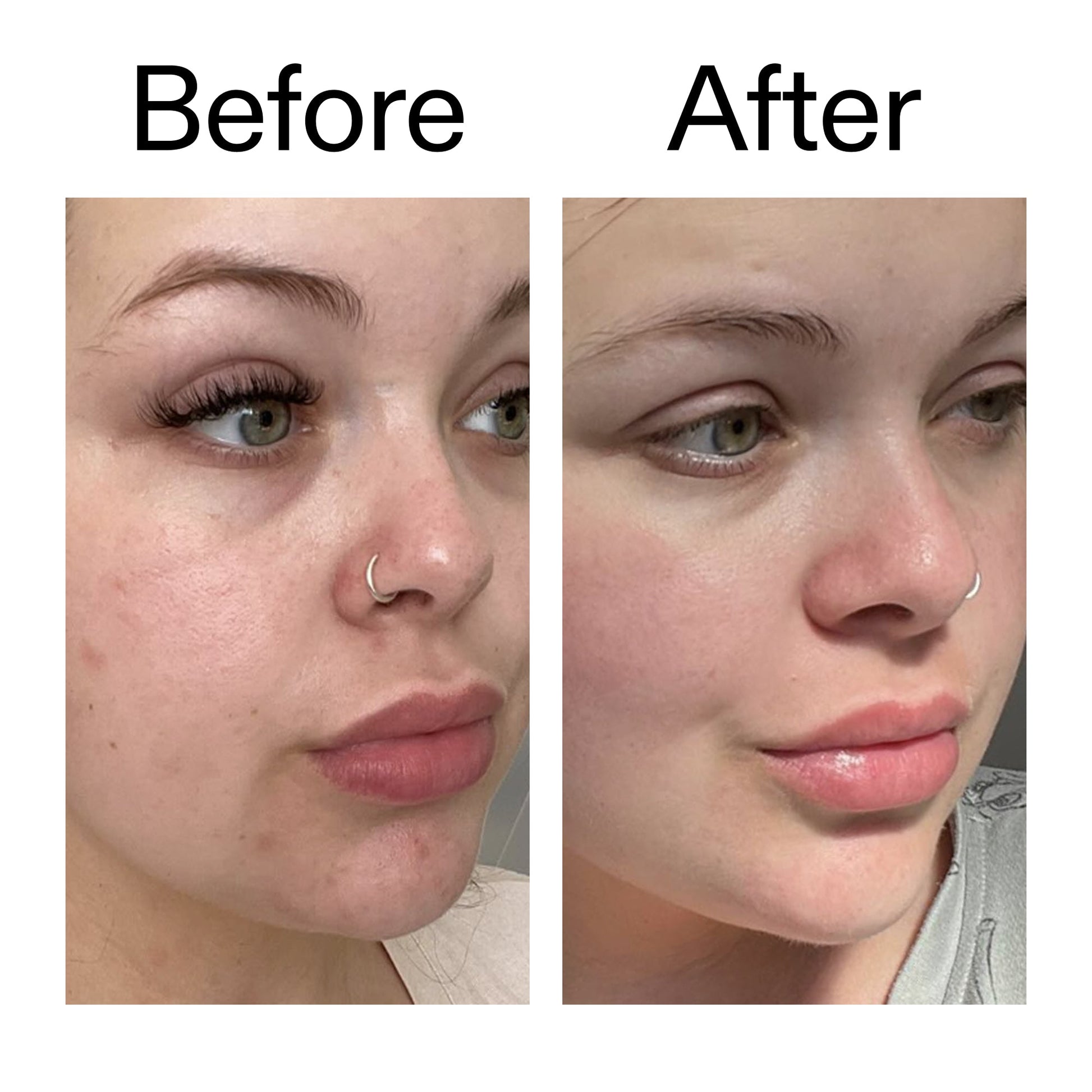 omega-water-cream-50ml-u4 Omega50_Before_After_2000x2000_46483ed8-3f9d-487f-9a0c-9df79830bd65.jpg