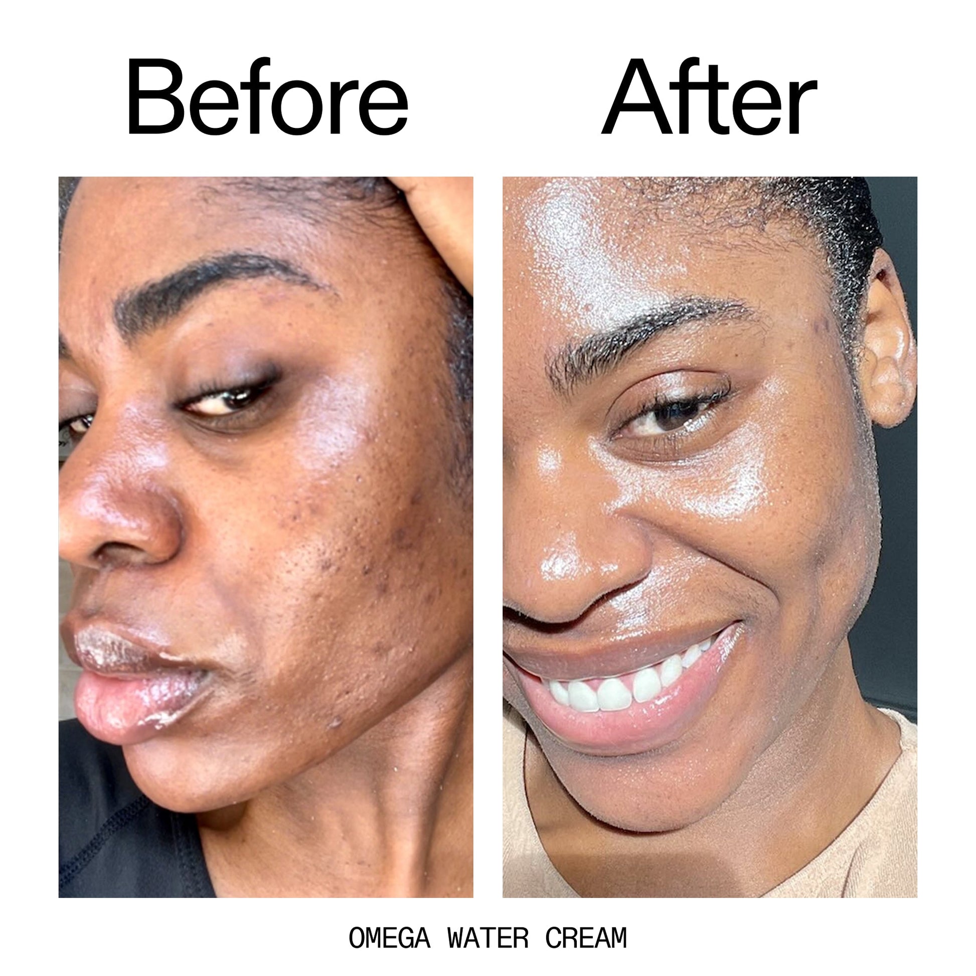 hydrating-cleanser-and-moisturizer-duo-i8 Omega_Water_Cream_Before_After_2000x2000_8e88278b-8c8d-48dc-ac77-4e98ebbd1b77.jpg
