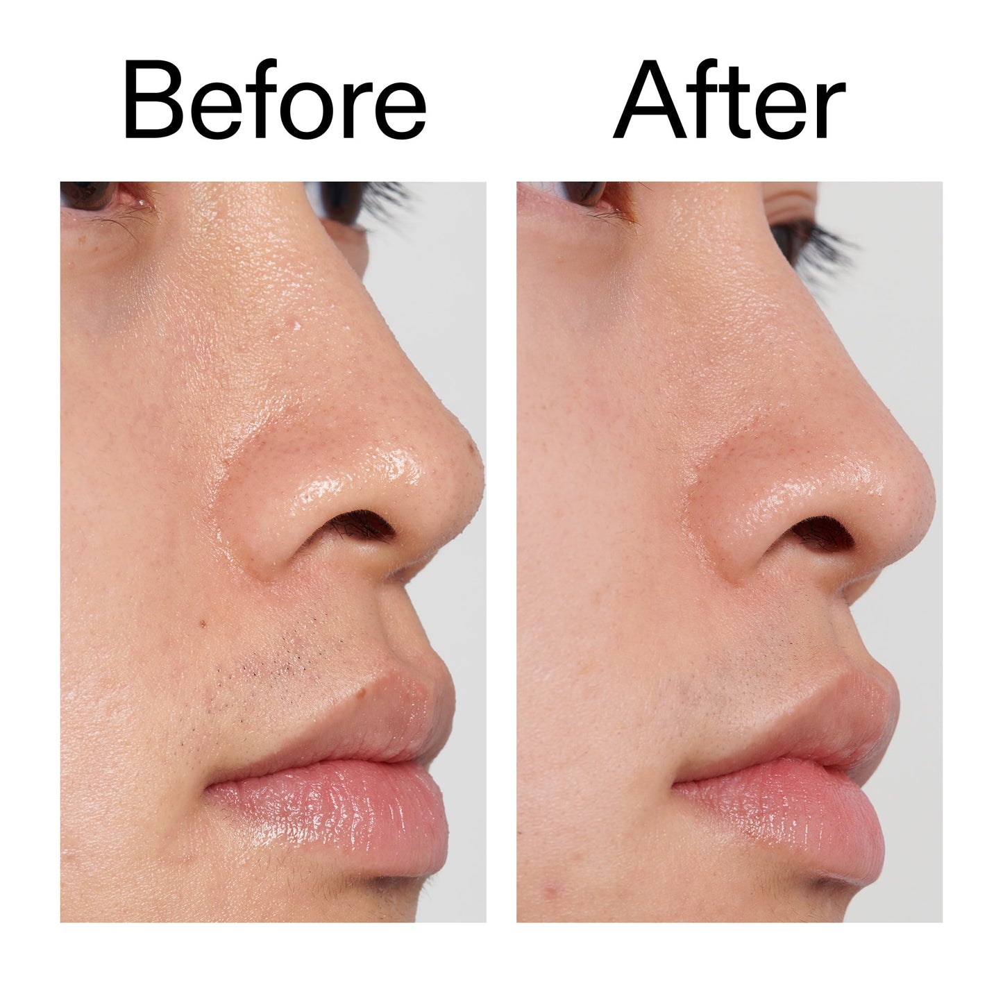 pha-toner-c9 PHA_Toner_Before_After_2000x2000_e3c10172-0150-4342-8b95-57417eaff50d.jpg