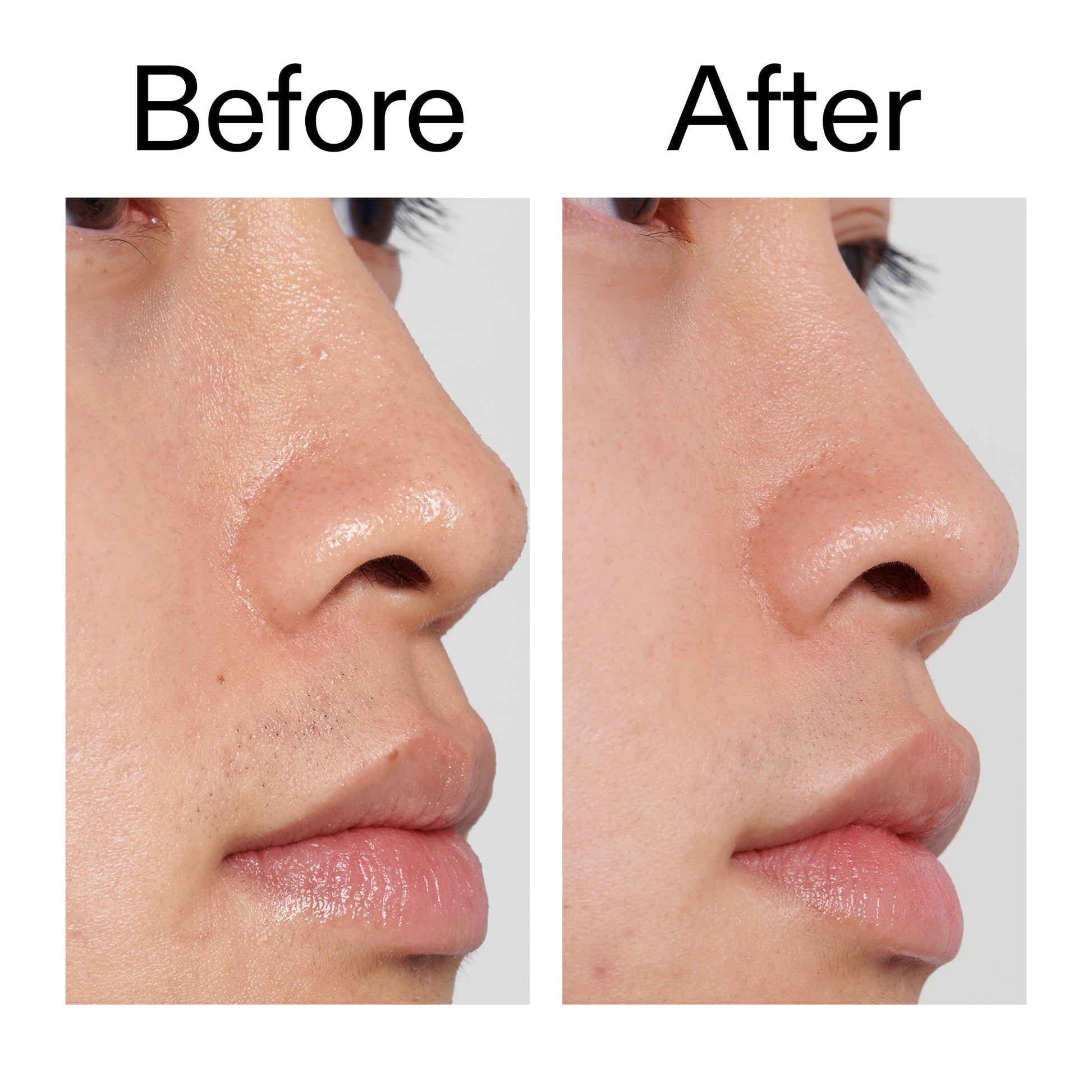 pha-toner-c9 PHA_Toner_Before_After_2000x2000_e3c10172-0150-4342-8b95-57417eaff50d.jpg