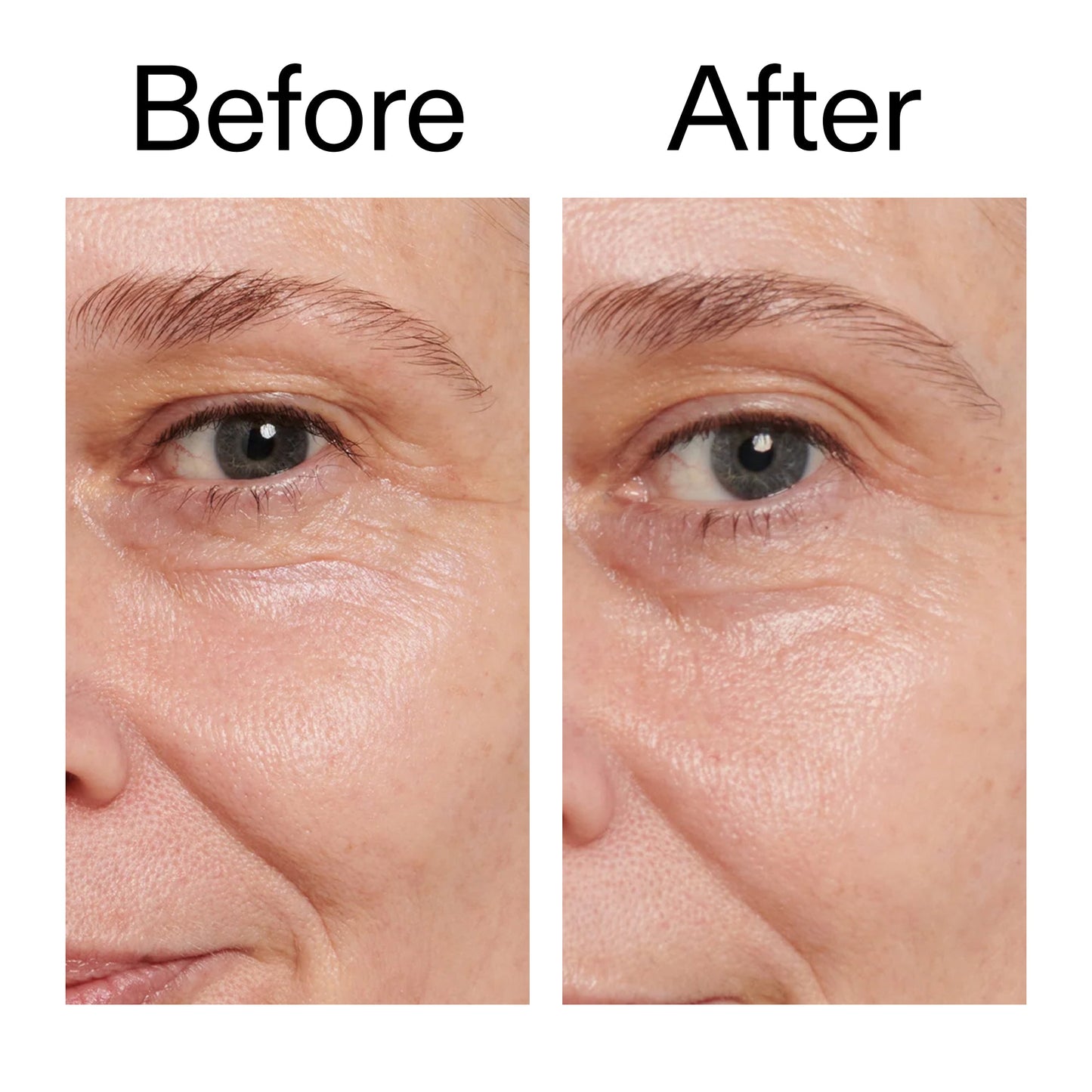 retinol-eye-cream-d5 Retinol_Eye_Cream_Before_After_2000x2000_ac03a80c-109e-4572-a95a-91dc109b4d27.jpg
