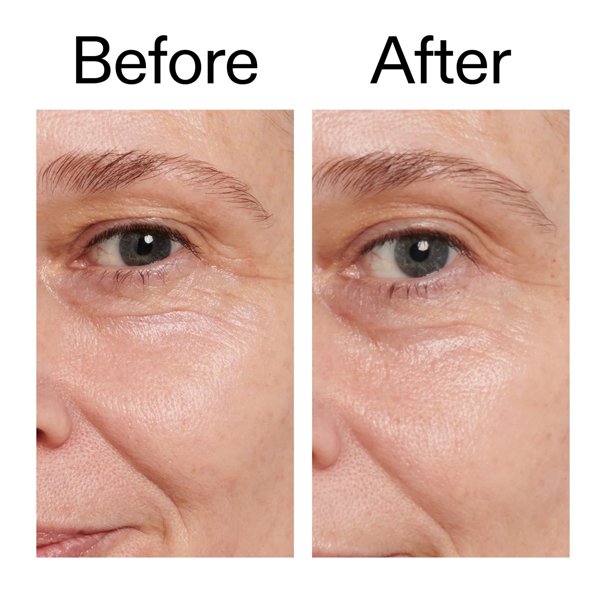 retinol-eye-cream-d5 Retinol_Eye_Cream_Before_After_2000x2000_ac03a80c-109e-4572-a95a-91dc109b4d27.jpg