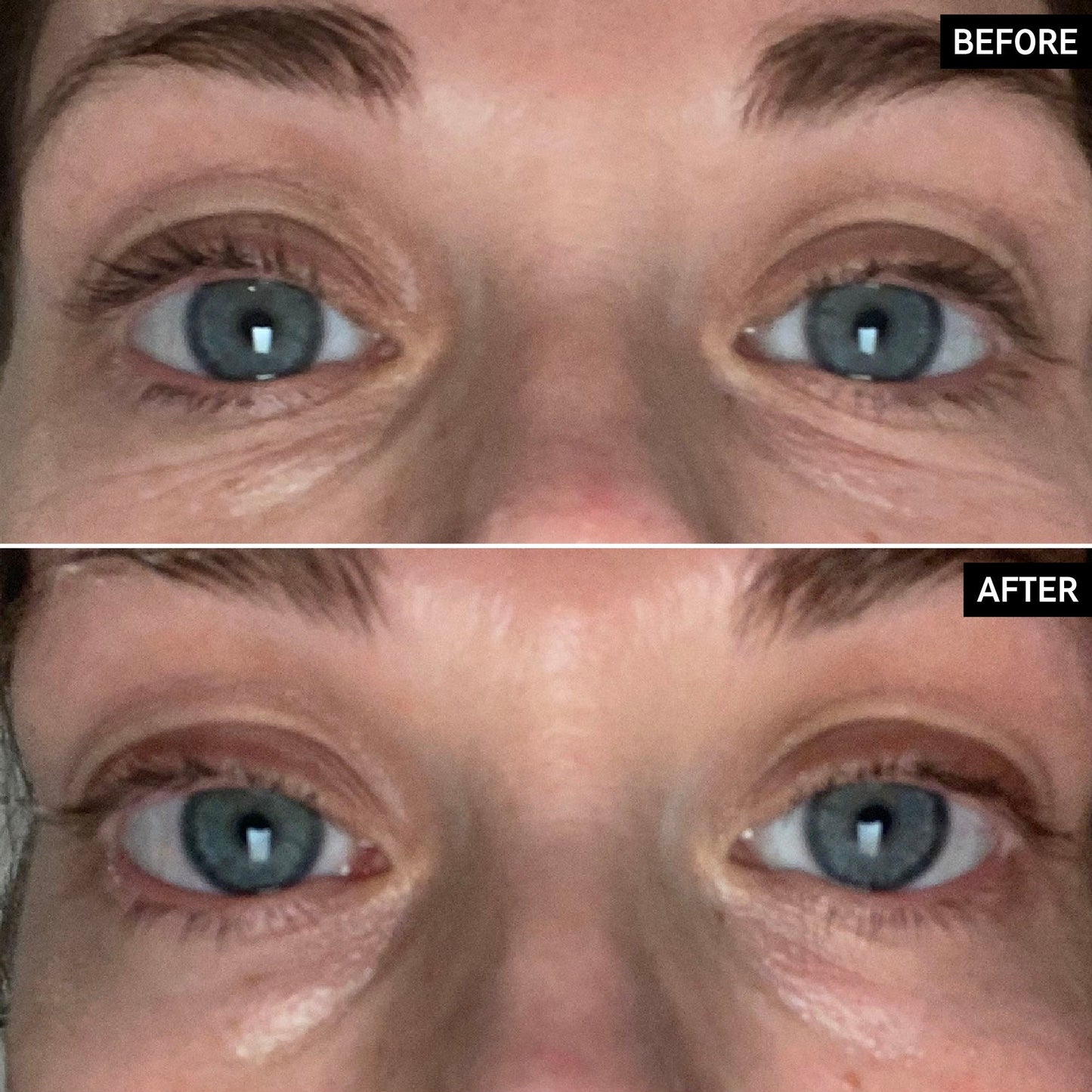 retinol-eye-cream-d5 SITE-UGCBAsApril_Nicole_B_A_PPage_2000x2000_1.jpg