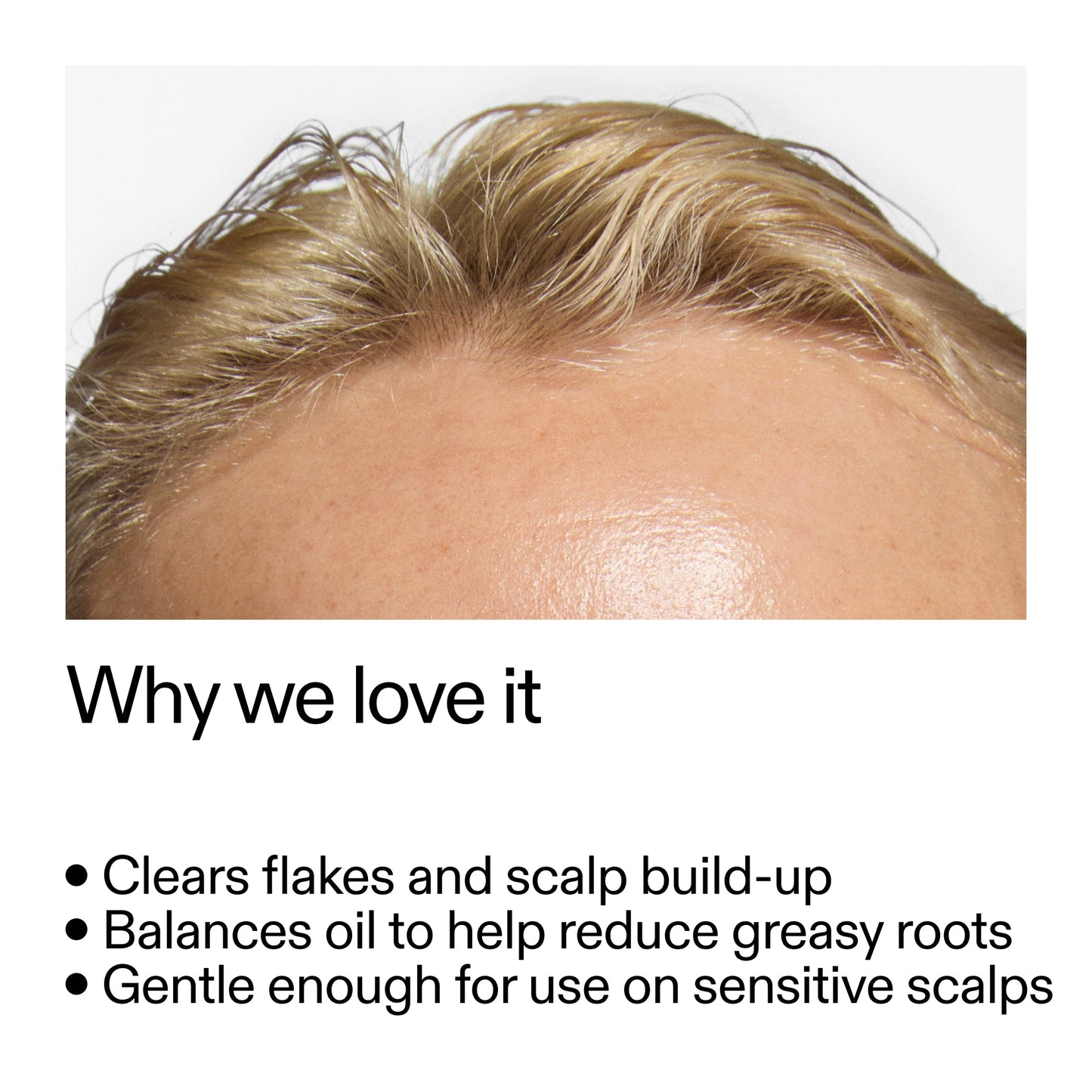 salicylic-acid-exfoliating-scalp-treatment-i1 Salicylic_Acid_Exfoliating_Scalp_Treatment_Why_we_love_it_2000x2000_44b6bd6d-9ec4-4b23-9dc4-bc3fd6f28e14.jpg