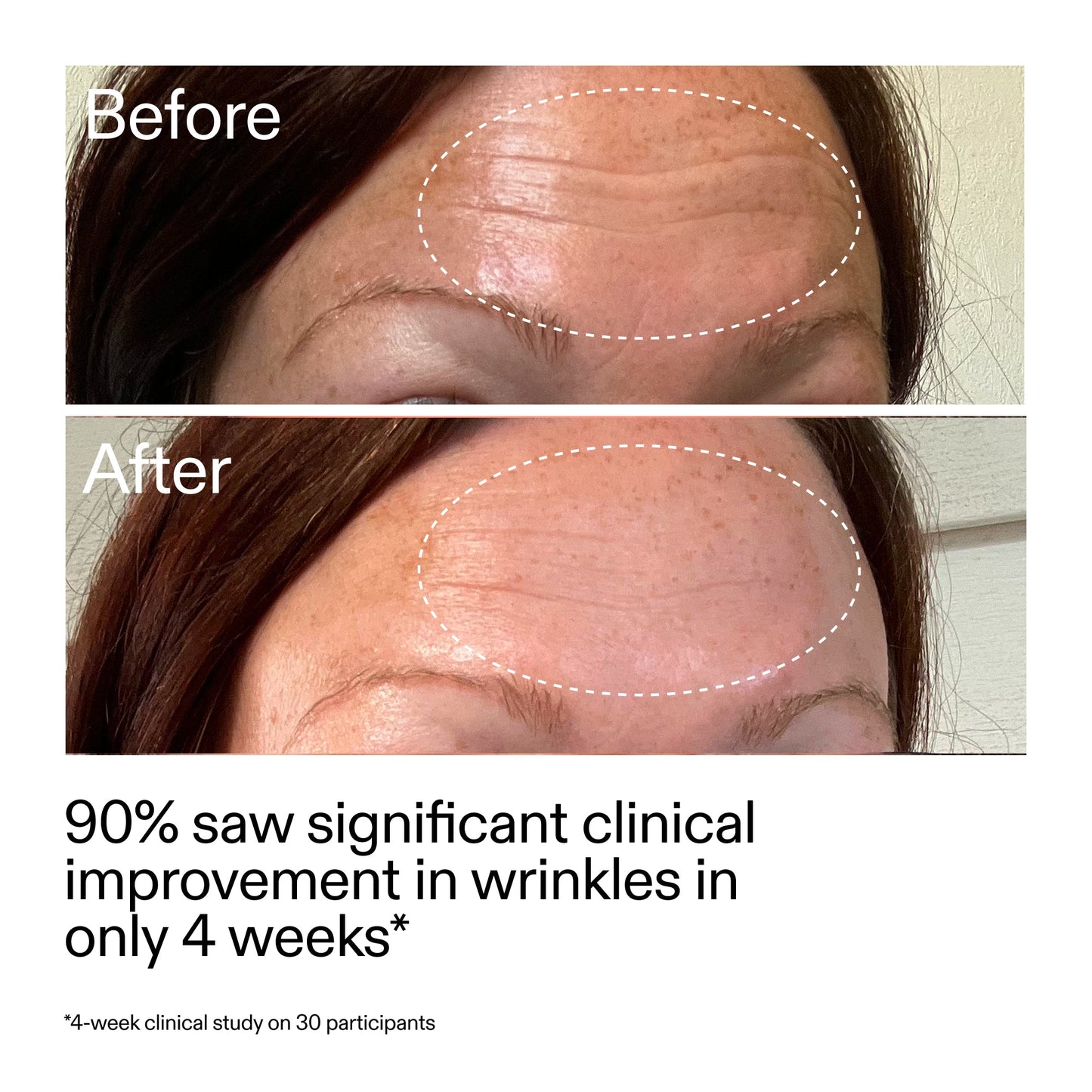 starter-retinol-serum-a2 StarterRetinol_BeforeAfter_Claim1_2000x2000_a09b50b6-4688-4527-abae-21bd142b89b7.jpg