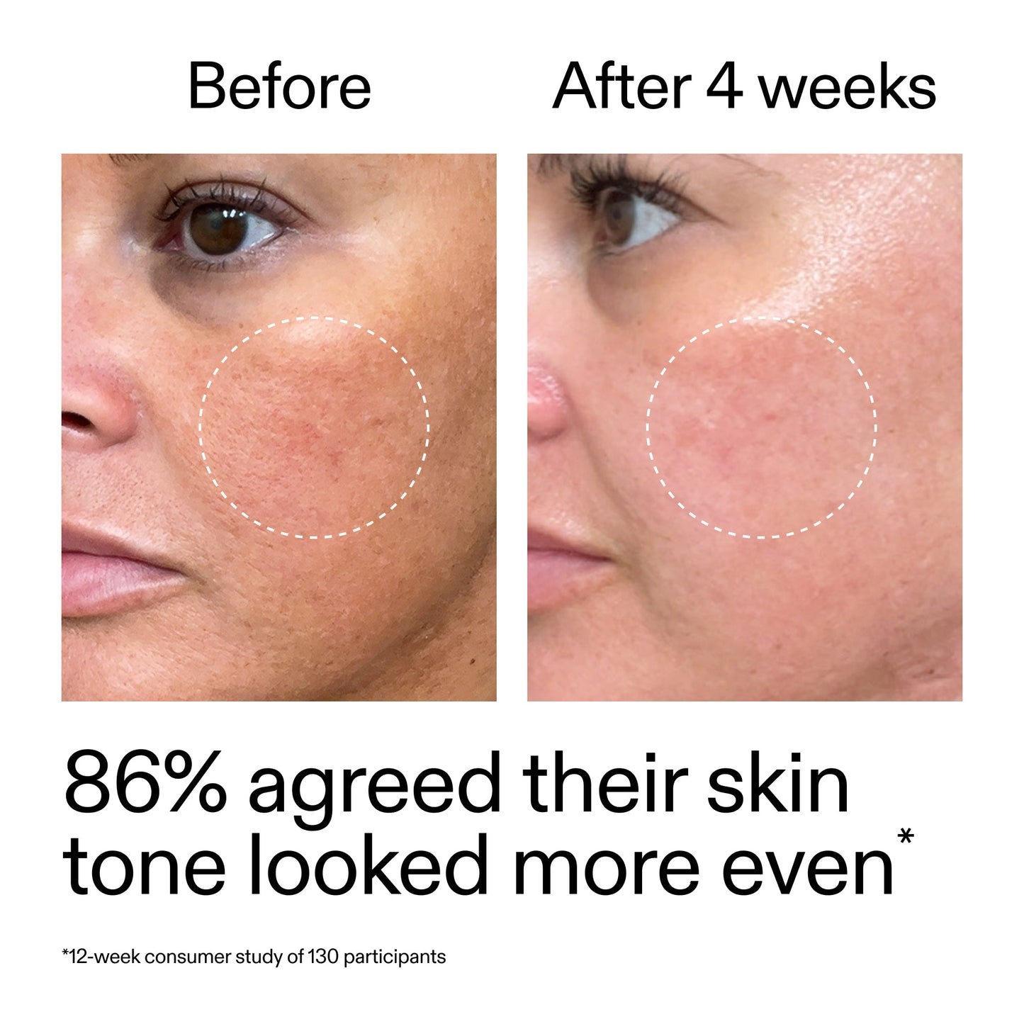 starter-retinol-serum-duo-e4 StarterRetinol_BeforeAfter_Claim2_2000x2000_fc5bb8ac-8588-478f-98d5-28af6651601a.jpg