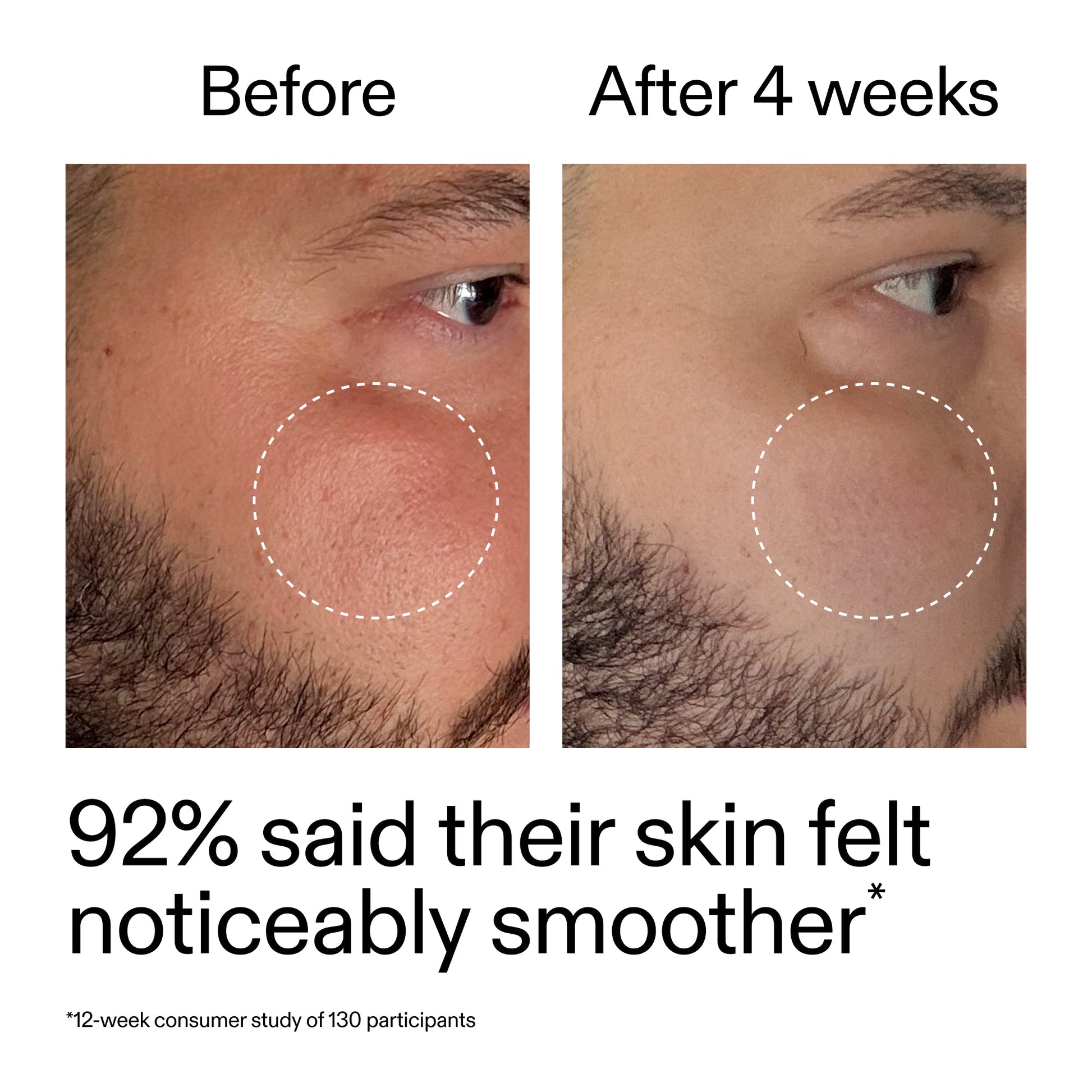starter-retinol-serum-duo-e4 StarterRetinol_BeforeAfter_Claim3_2000x2000_458243a8-bbb0-4e5d-a274-29c7766d339b.jpg