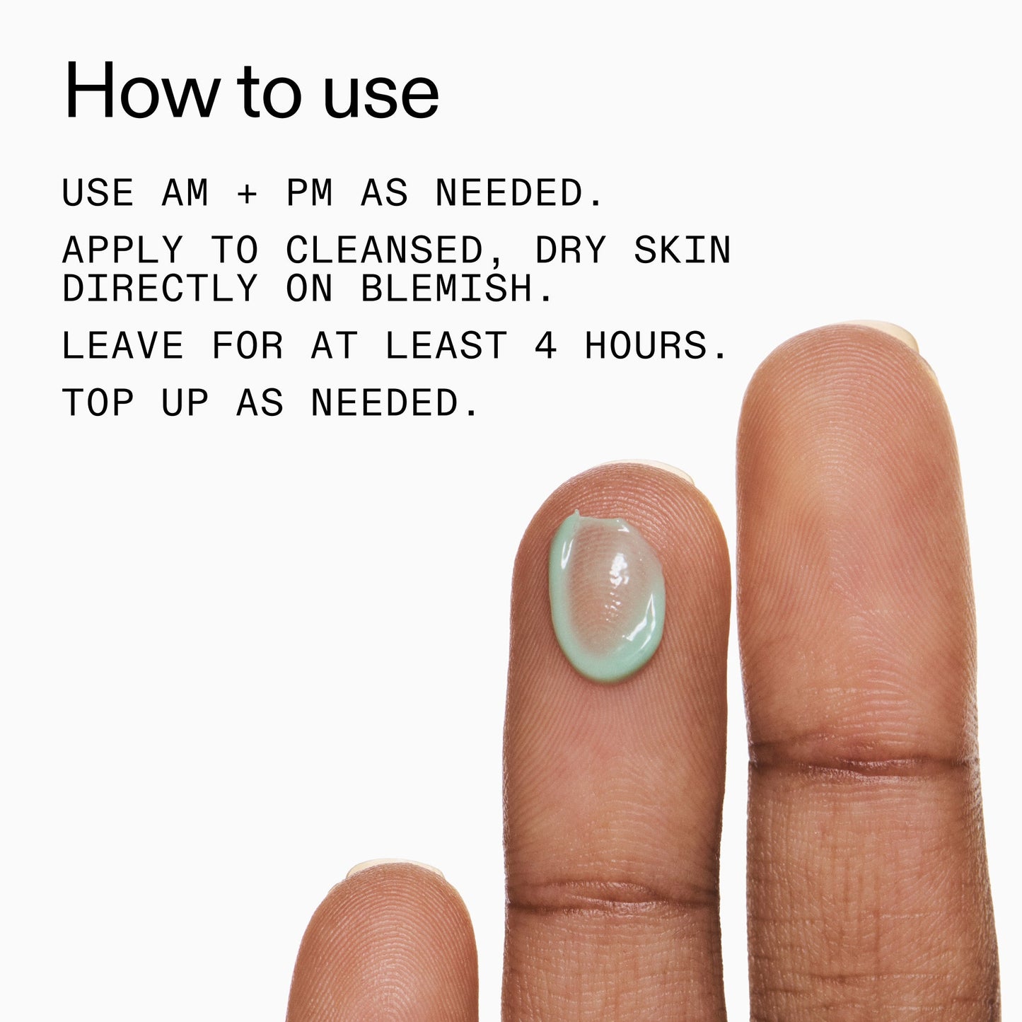 succinic-acid-acne-treatment-b4 Succinic_Acid_Treatment_How_to_Use_2000x2000_d57137d5-d7f1-427c-9a46-5fc00c19c542.jpg