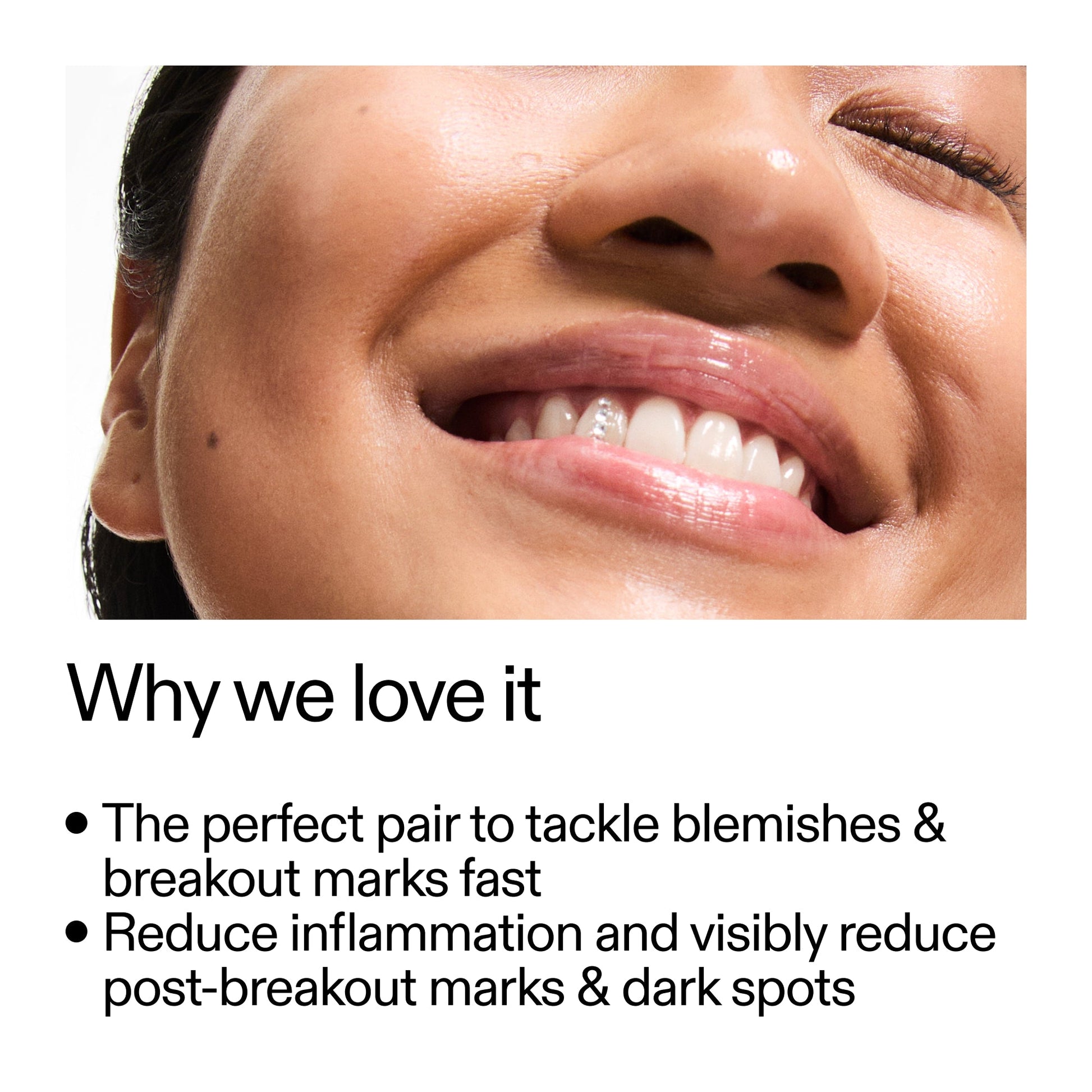 targeted-blemish-duo-y4 Targeted_Blemish_Duo_Why_we_love_it_2000x2000_ff00be46-438b-485f-b5c3-91e60bbb6919.jpg