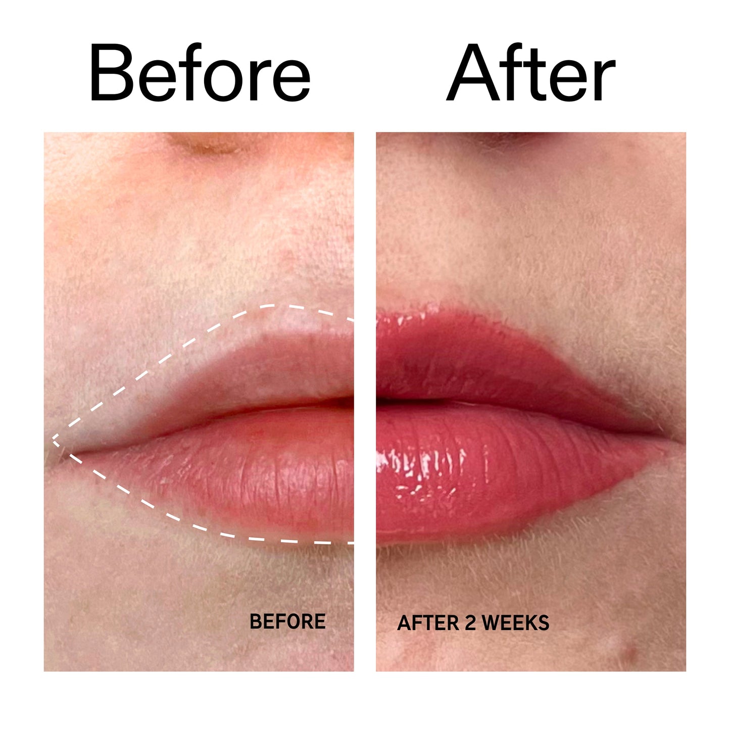 tripeptide-plumping-berry-lip-balm-o2 Tripeptide_Plumping_Lip_Balm_-_Berry_Before_After_2000x2000_9474bbd8-43ca-4b0e-b0e7-dfab70b91927.jpg