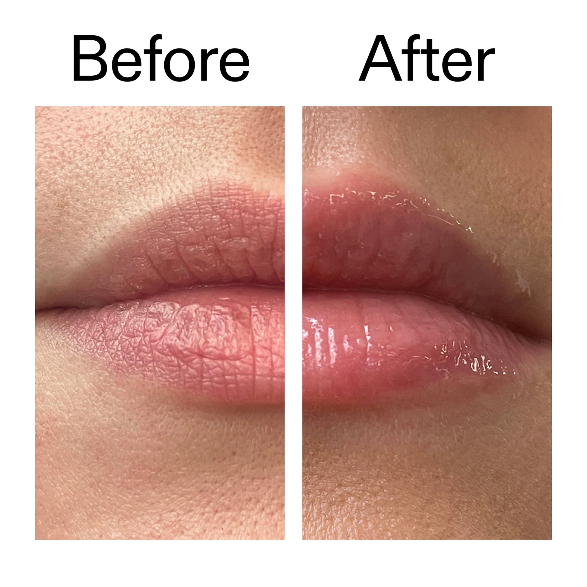 lip-plumping-duo-z0 Tripeptide_Plumping_Lip_Balm_Before_After_2000x2000_b4a5ee04-d2ac-4857-8f01-17209acc4bf3.jpg