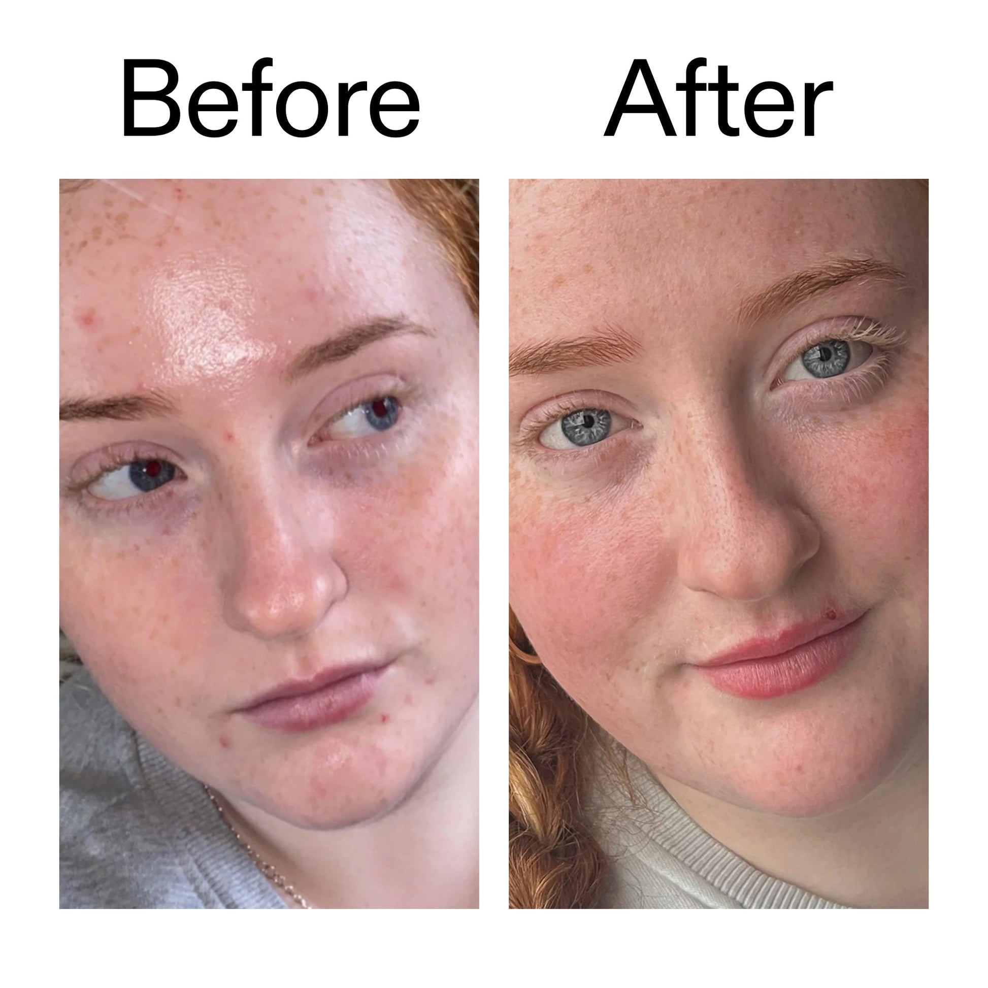 vitamin-b-c-and-e-moisturizer-h5 Vitamin_B_C_and_E_Moisturizer_Before_After_2000x2000_b0781a76-5ad2-4be9-95b8-ef92b356833c.jpg